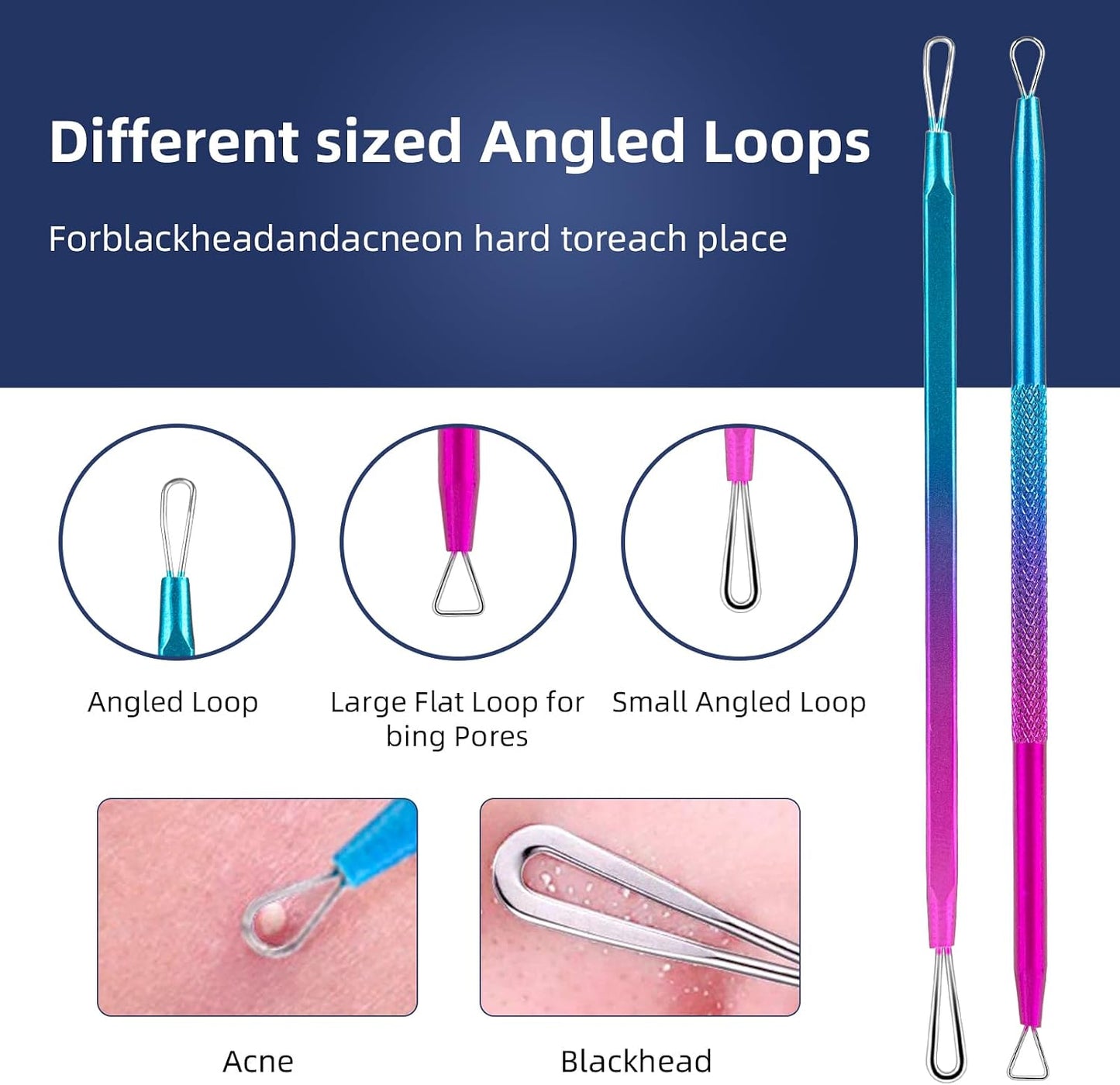 Pimple Popper Tool Kit - 10-Piece Blackhead Remover Set with Metal Case for Easy Comedone Extraction | Colorful