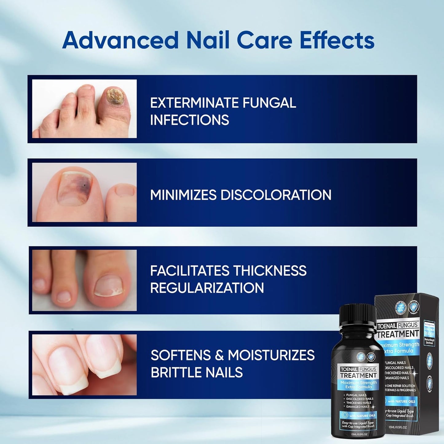 Maximum Strength Toenail Fungus Treatment - Antifungal Solution with Undecylenic Acid for Thick, Brittle Nails | 30ml