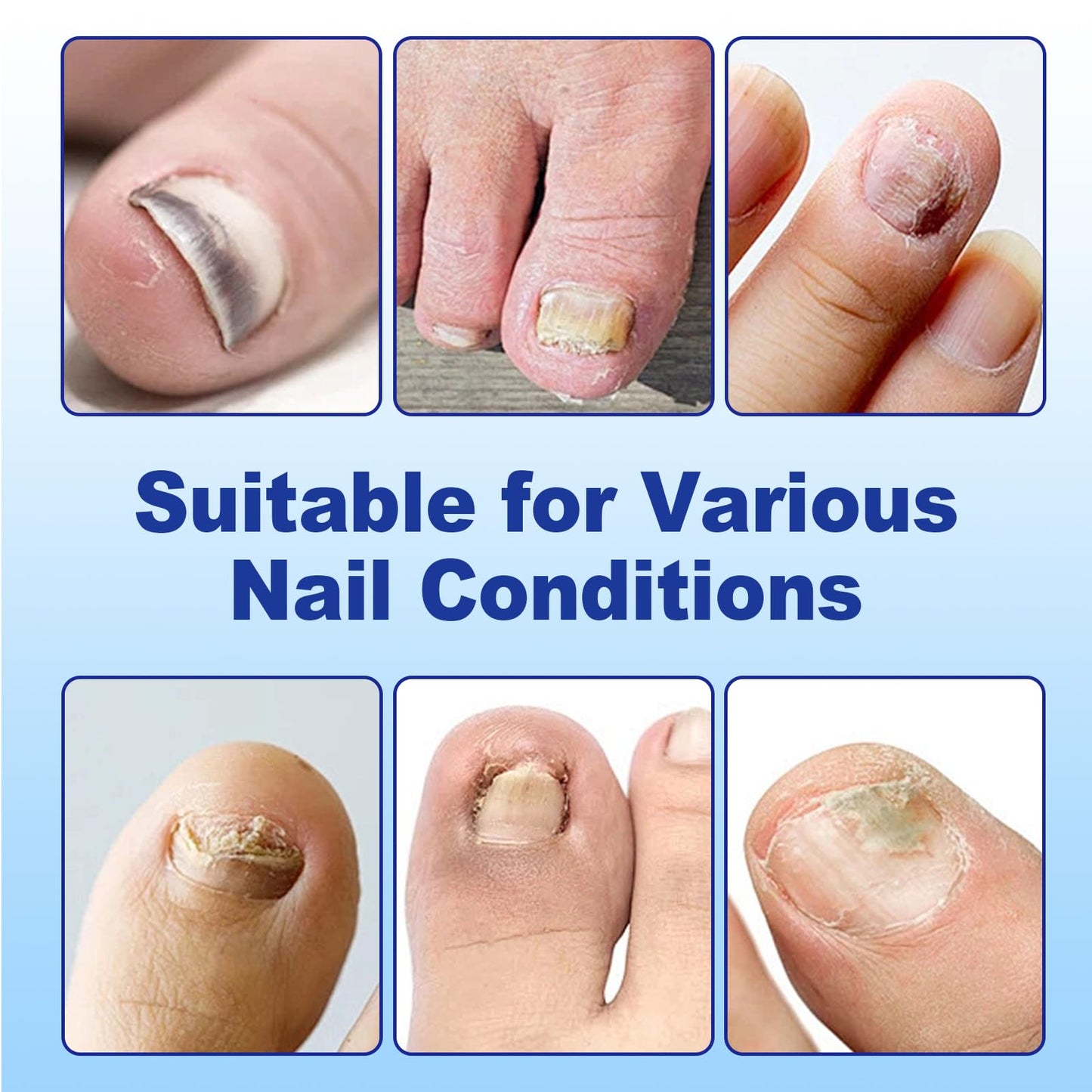 Nail Patches 42 Count, Extra Strength 8-Hour Overnight Fast Nail Care Patches, Nails Patch for toenails Fits Large and Small Nails for Men and Women