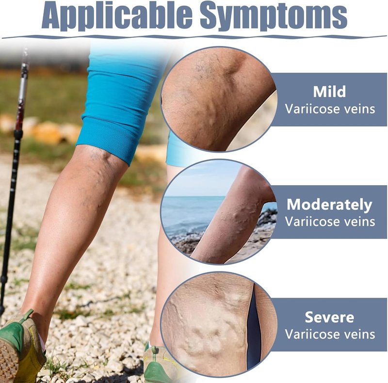 Varicose Veins Patch - 36PCS Natural Relief for Spider Veins | Strengthen Capillary Health & Improve Circulation