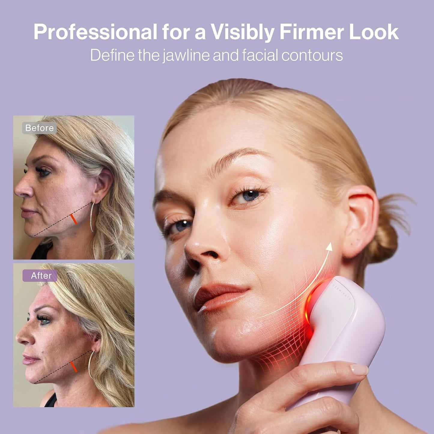 DermRays Microcurrent Device - 4-in-1 Facial Toning Tool with 650nm Red Light for Youthful Skin