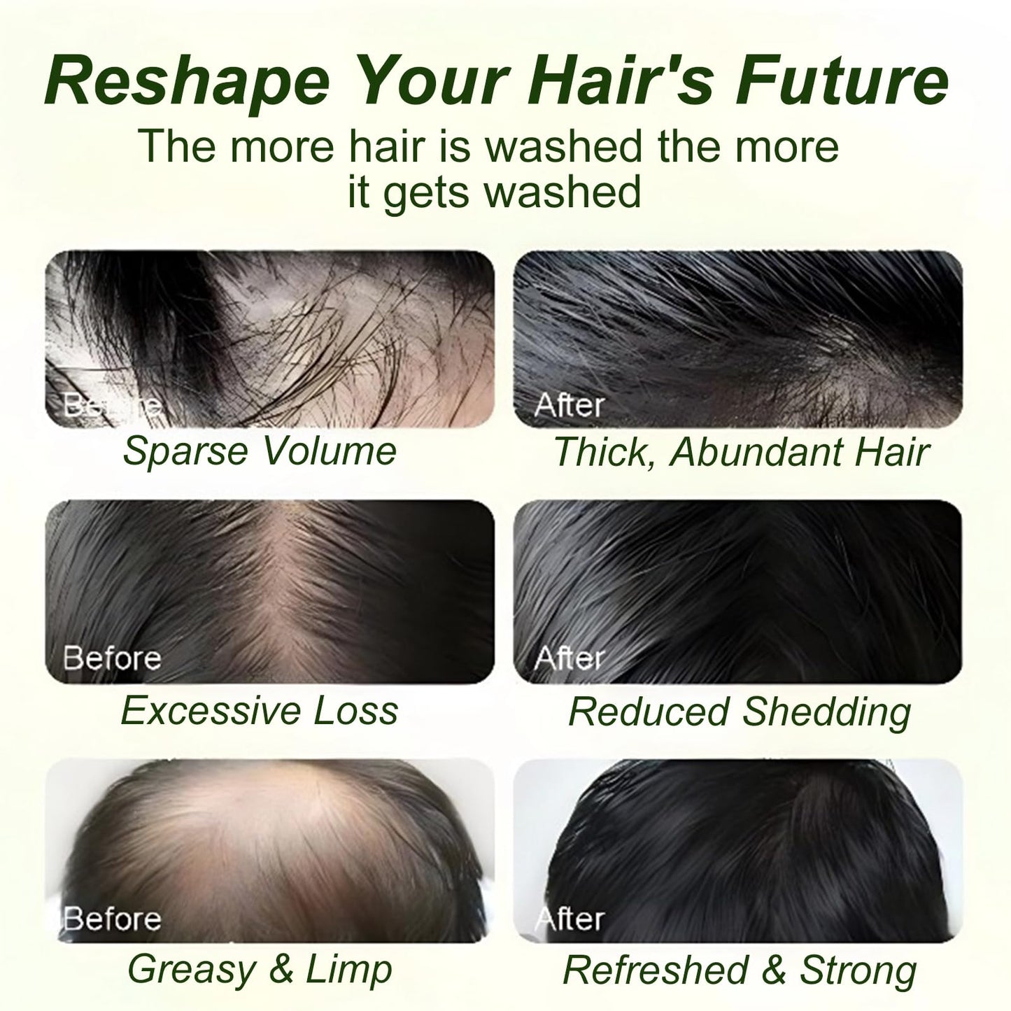 Tgideas Batana Oil Rosemary Shampoo for Hair Growth & Hair Loss, 1 Pack