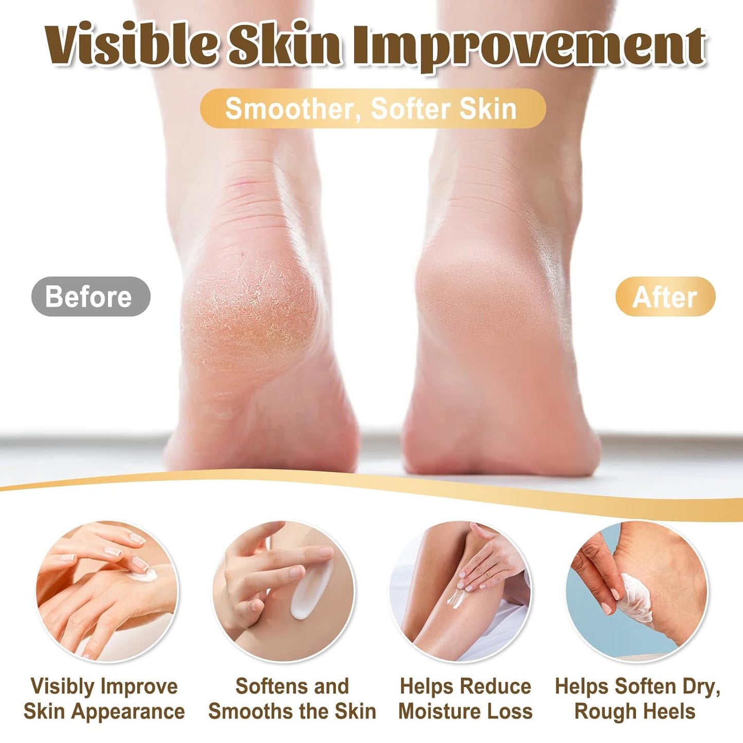 Urea Cream for Feet 40% - Maximum Strength Foot Moisturizer for Dry Cracked Heels & Calluses | Deep Softening Formula