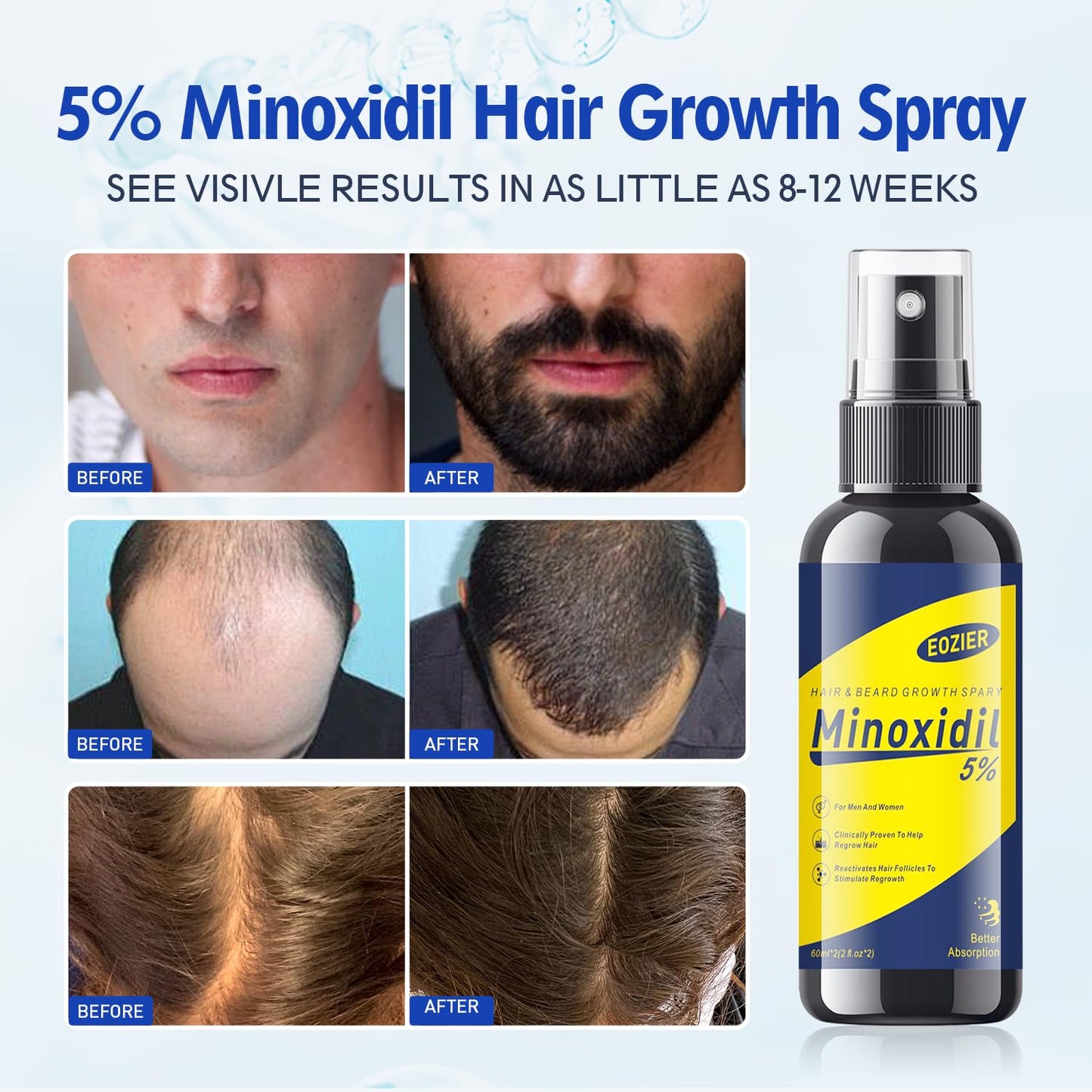 Minoxidil Hair Regrowth Treatment - 5% Solution with Biotin for Thinning Hair | 4 FL OZ/120mL