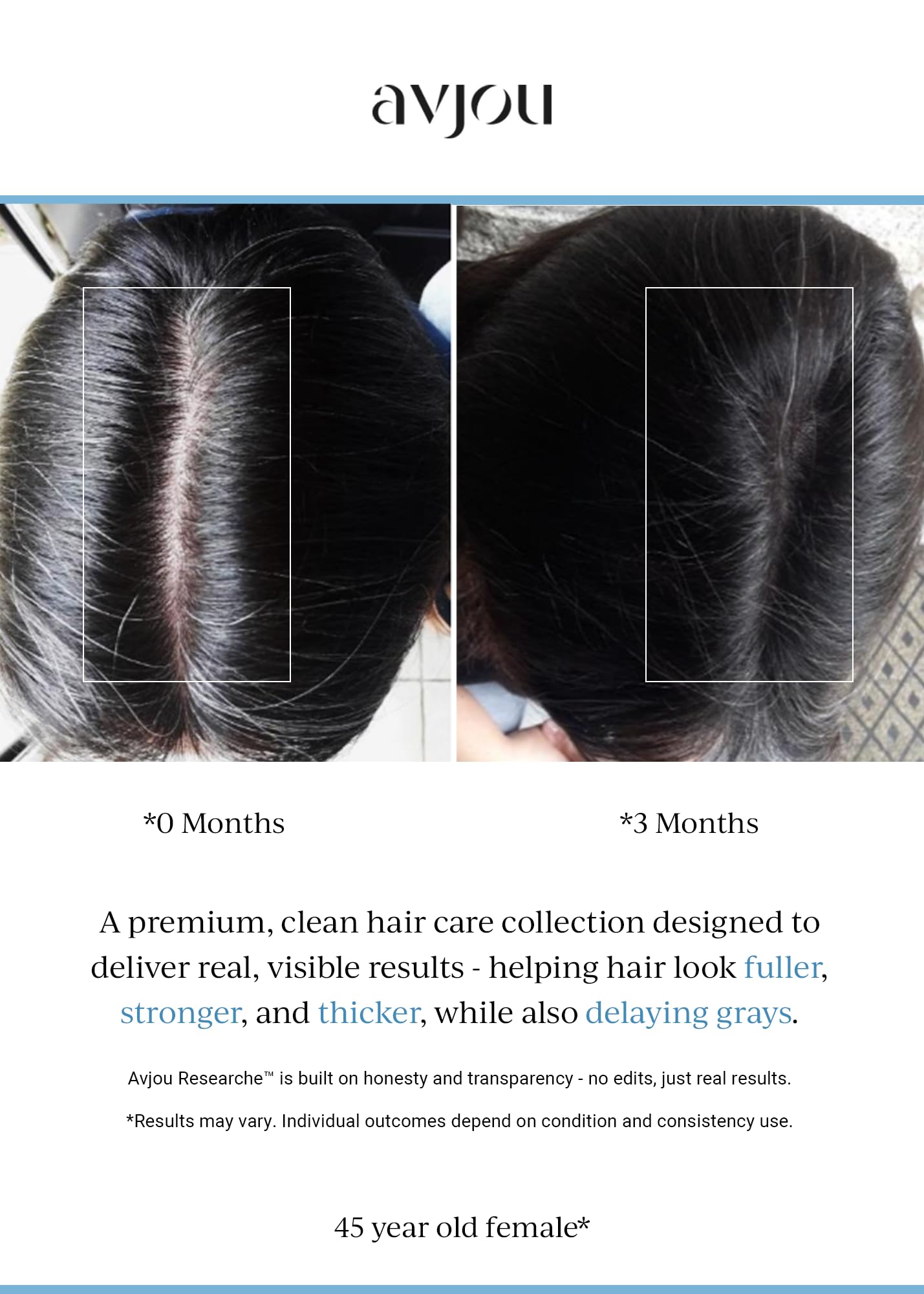 Avjou Researche™ Scalp Serum – Thicker, Fuller-Looking Hair + Targets Visible Signs of Premature Greying – 3 Patented Ingredients – Backed by Cosmetic Science – Oil-Free, All Hair Types, 1.7 oz
