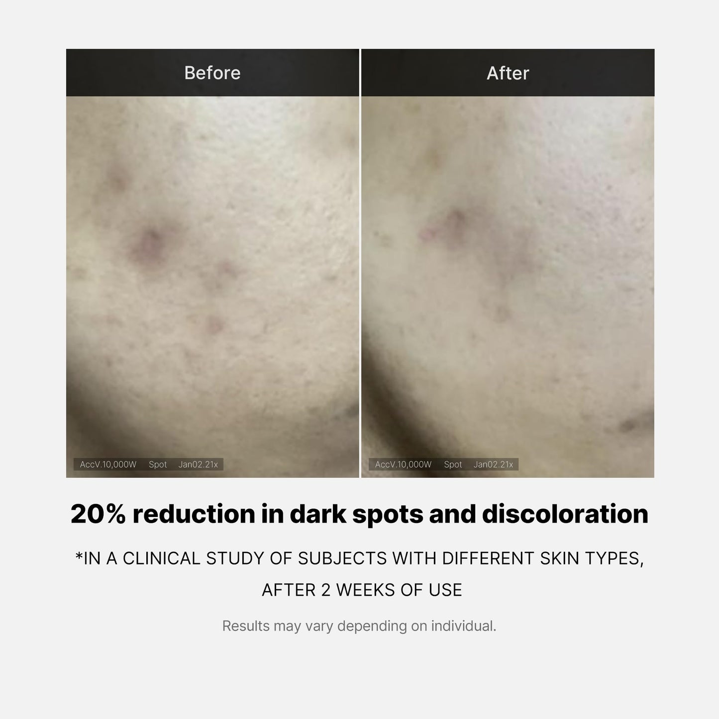 medicube Deep Vita C Serum 2.0 | Pure Vitamin C for Radiance & Glow