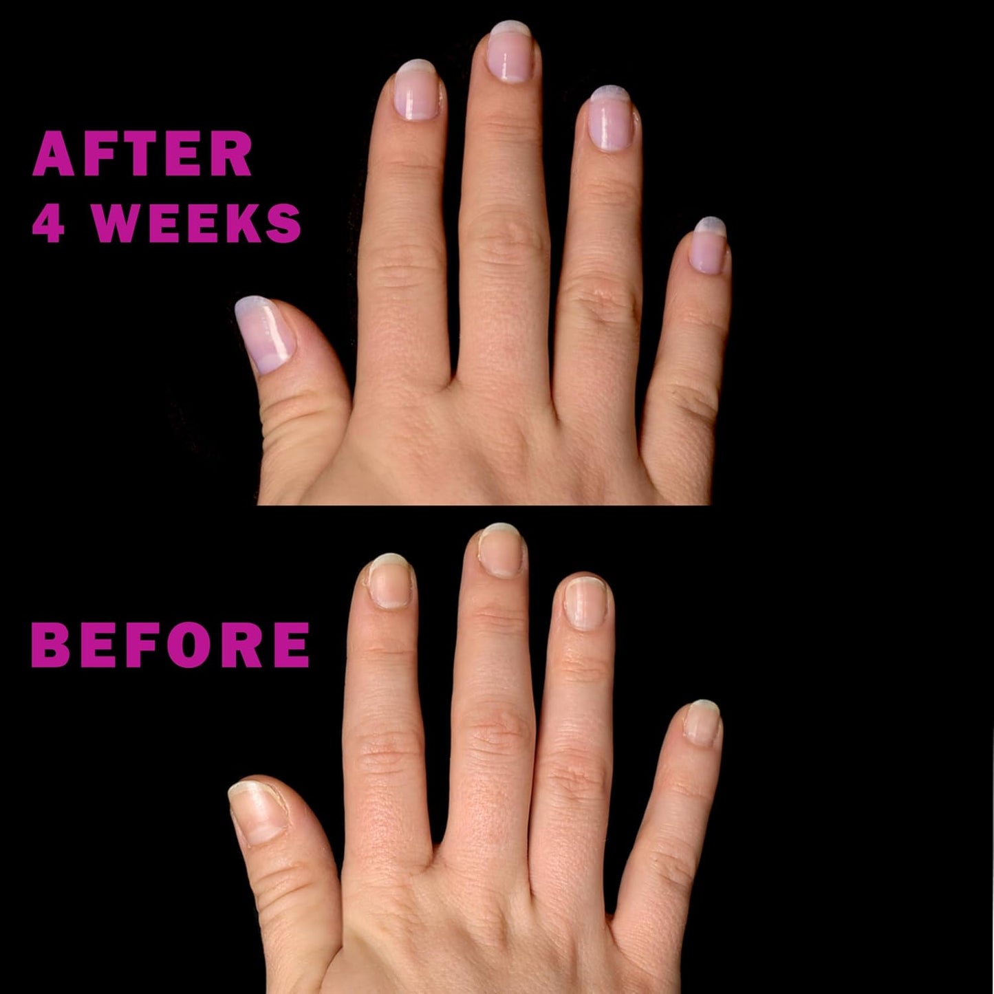 Nail Essentials Kit - 4-Piece Keratin Nail Strengthener & Growth | Repair Damaged Nails for High Gloss Finish
