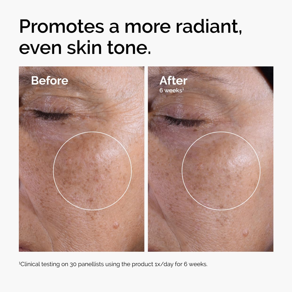 The Ordinary Glycolic Acid 7% Exfoliating Toner - Brightening Daily Toner for Even Skin Tone