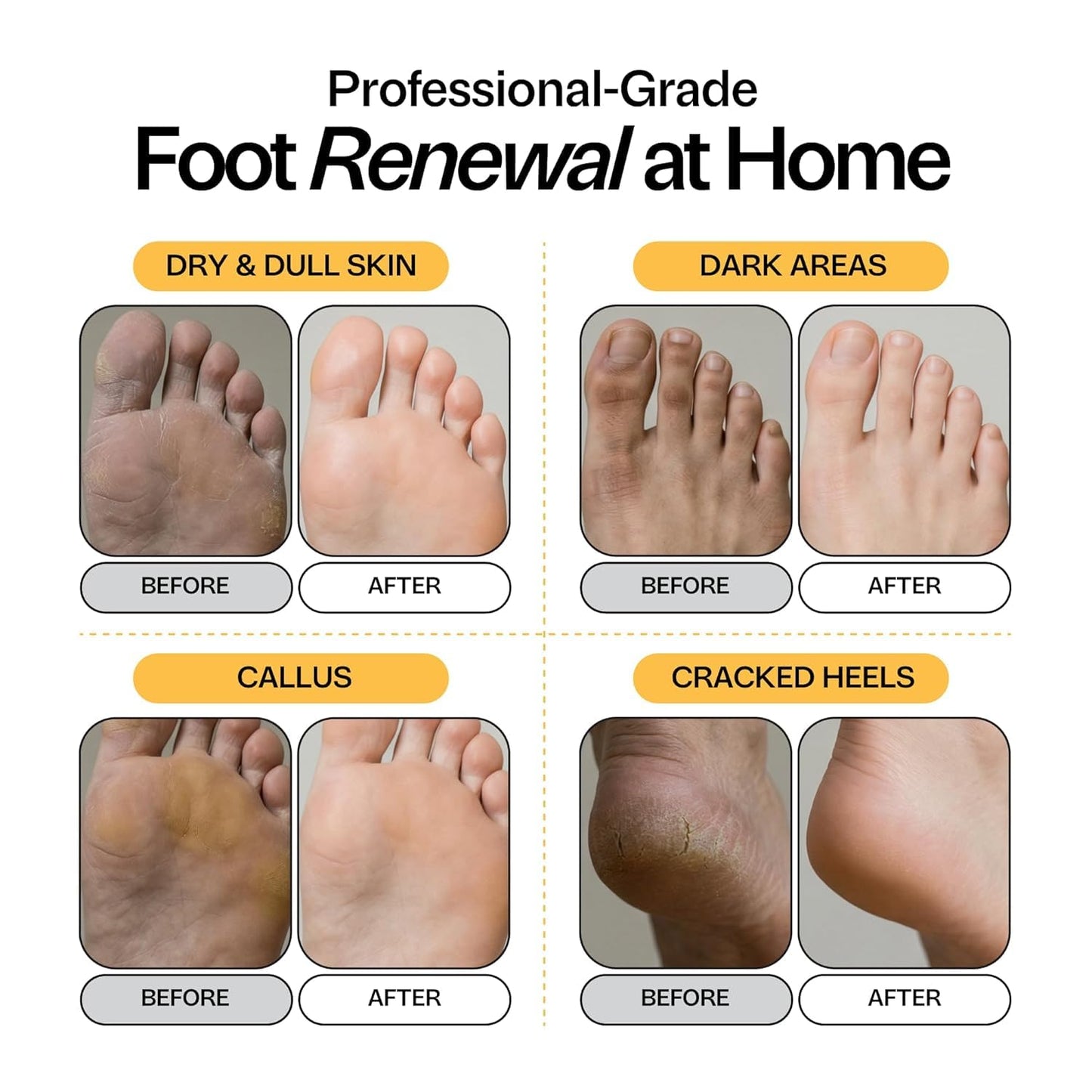 Foot Choice Skin Brightening Foot Soak with Kojic Acid & Niacinamide - Evens Skin Tone, Boosts Glow & Softens Calluses - Turmeric & Vitamin C - 2 Pack