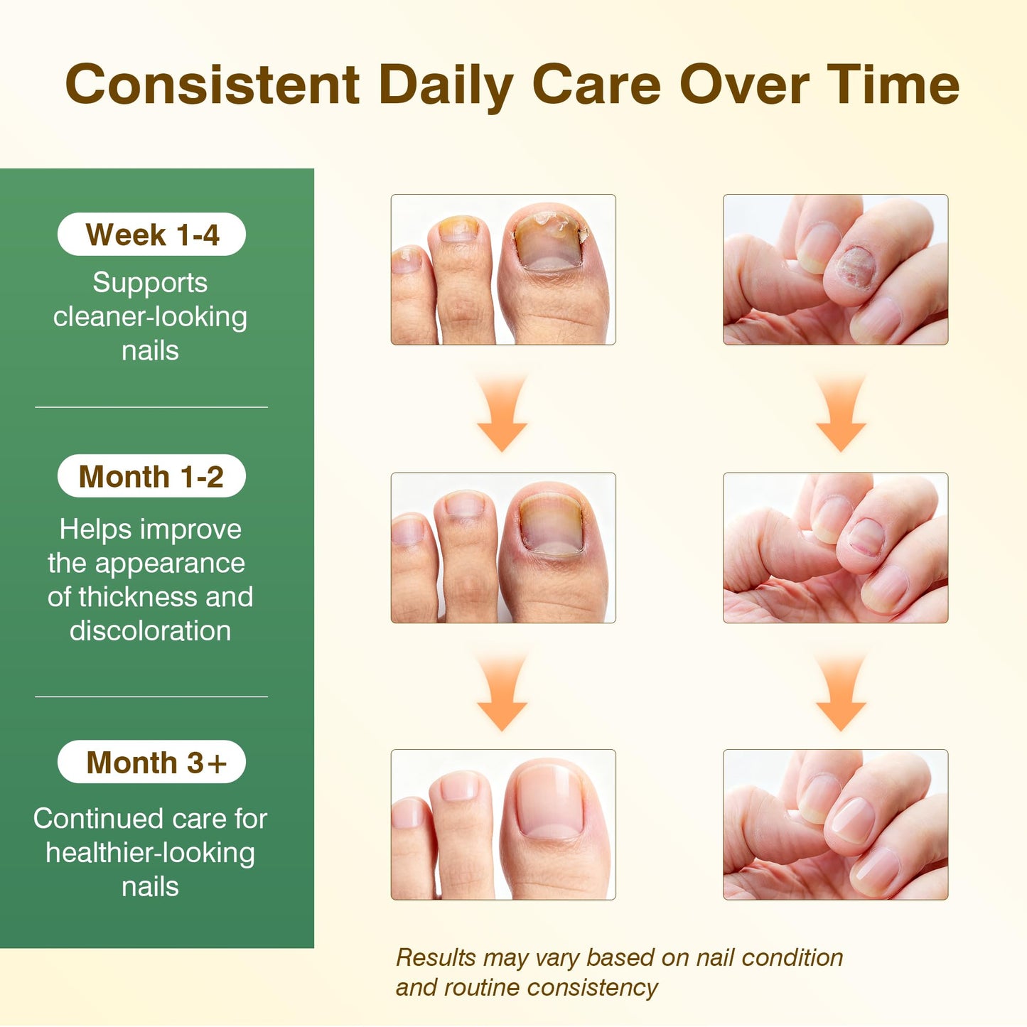 Toenail Fungus Treatment ExtraStrength - Nail Repair for DamagedNails, Nail Repair with 25% UndecylenicAcid & Tolnaftate, Toenail FungusTreatment for Fungal ToenailFingernails & Athletes Foot 3PCS
