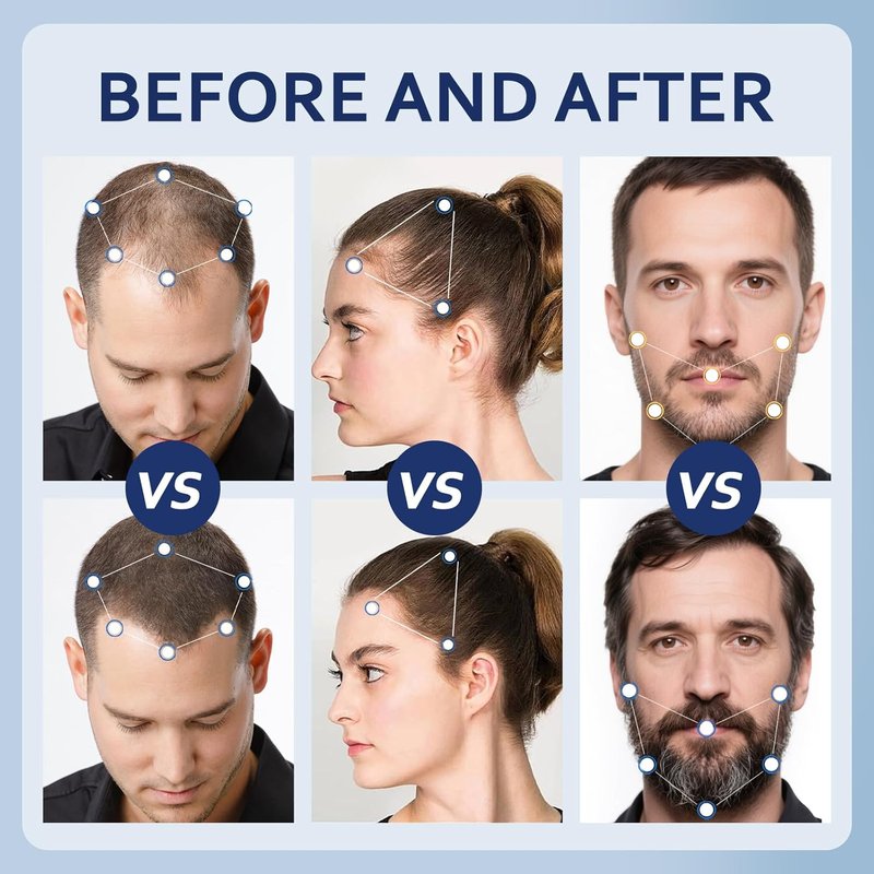 5% Minoxidil Hair Growth Serum - Extra Strength Regrowth Treatment with Biotin | 12 FL OZ Dropper