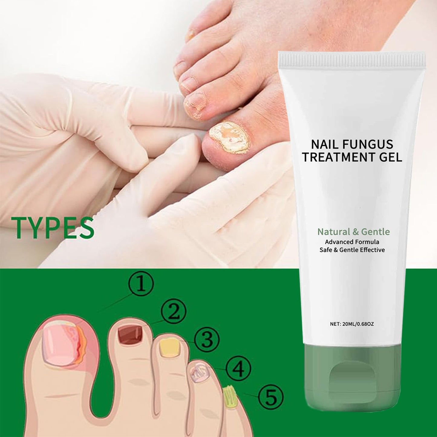 Nail Treatment Gel, Nail Growth Serum for Repair & Strengthener
