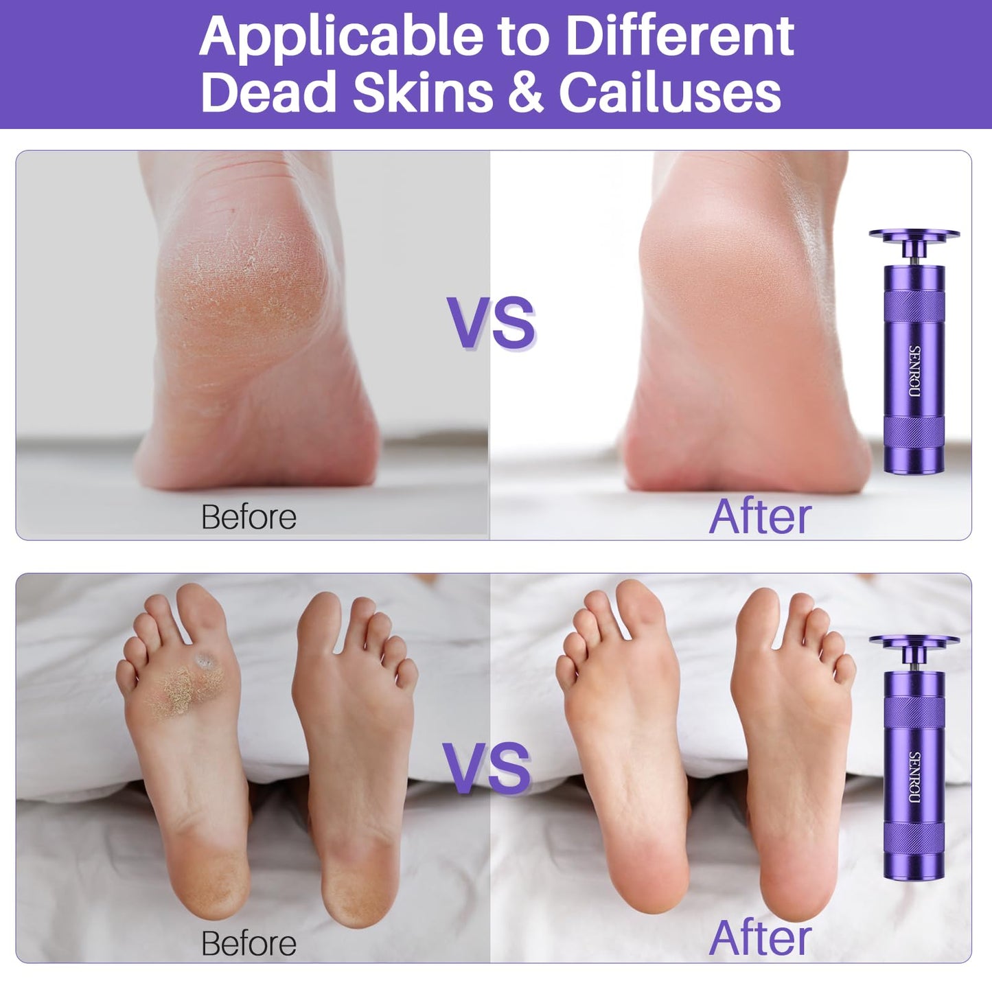 Electric Foot Callus Remover, 2-in-1 Electric Foot Filer/Nail Filer, Callus Remover for Feet with 60Pcs+12Pcs Sandpaper Discs，Holiday Gift Foot Repair Tool, Purple