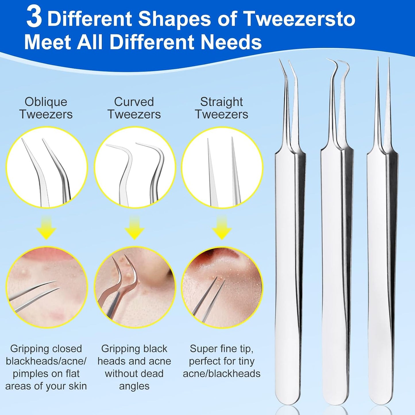 Pimple Popper Tool Kit - 10-Piece Blackhead Remover Set | Professional Comedone Extractors for Acne & Zit Removal, Metal Box Included (Silver)