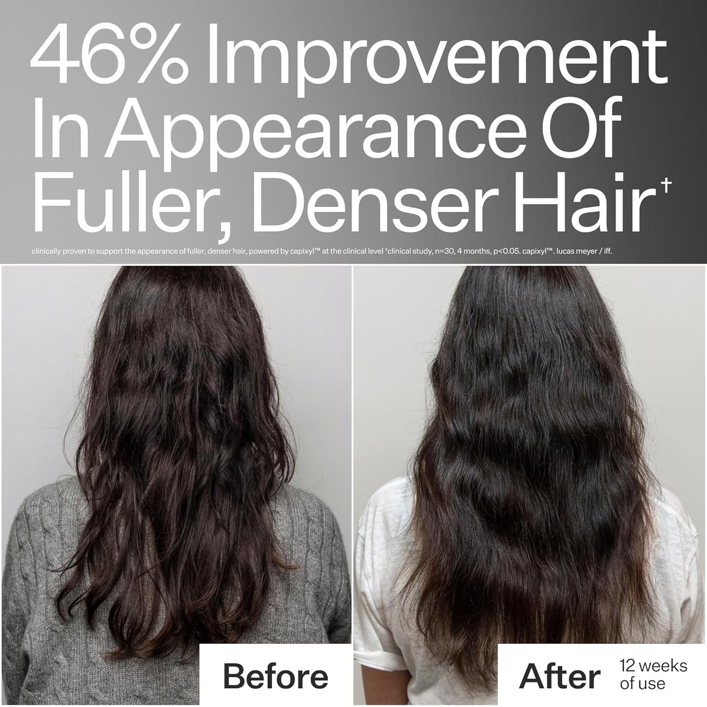 Cold Processed Stem Cell Peptide Hair Treatment - Boosts Density with Grape Stem Cells & Caffeine | Vegan, Fragrance-Free | 3 Fl Oz