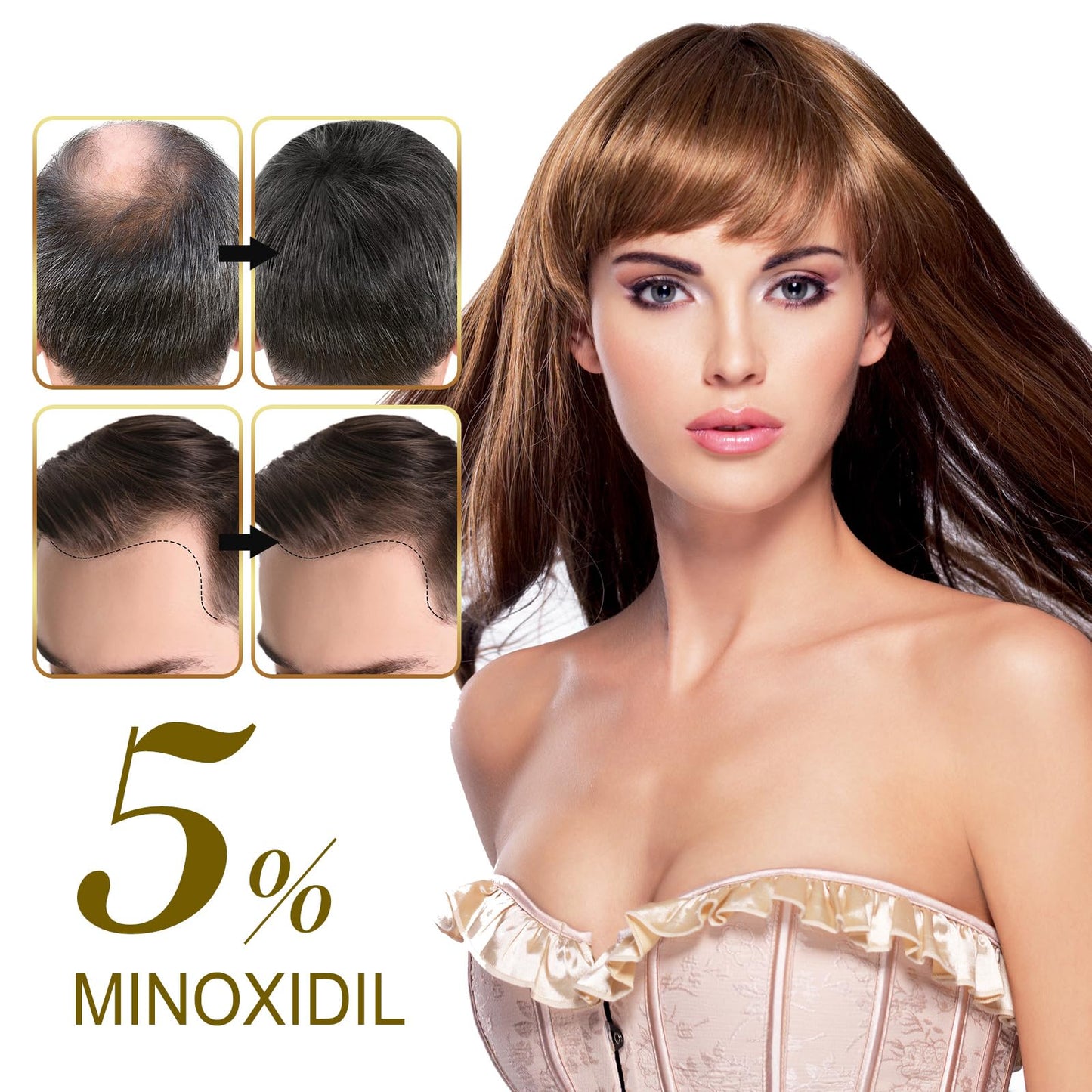 5% Minoxidil Hair Growth Serum for Men & Women - for Stronger Thicker Longer, Hair Regrowth Treatment- 2.02 oz