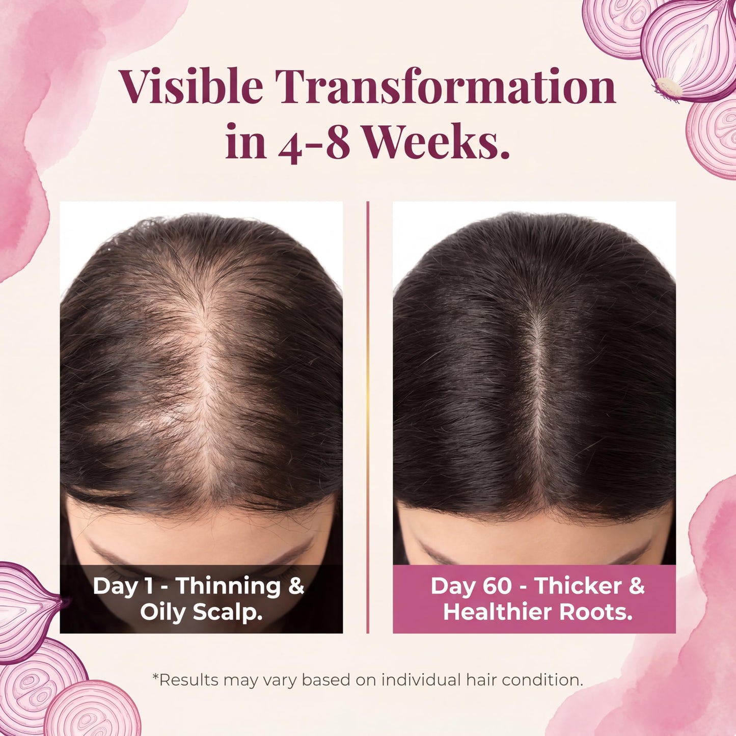 2 Pack Onion Biotin & Rosemary Shampoo Bar for Hair Growth & Anti-Hair Loss, 3-in-1 Hydrating Hair Soap for Thinning Hair, Moisturizing Cleanser Hair Care