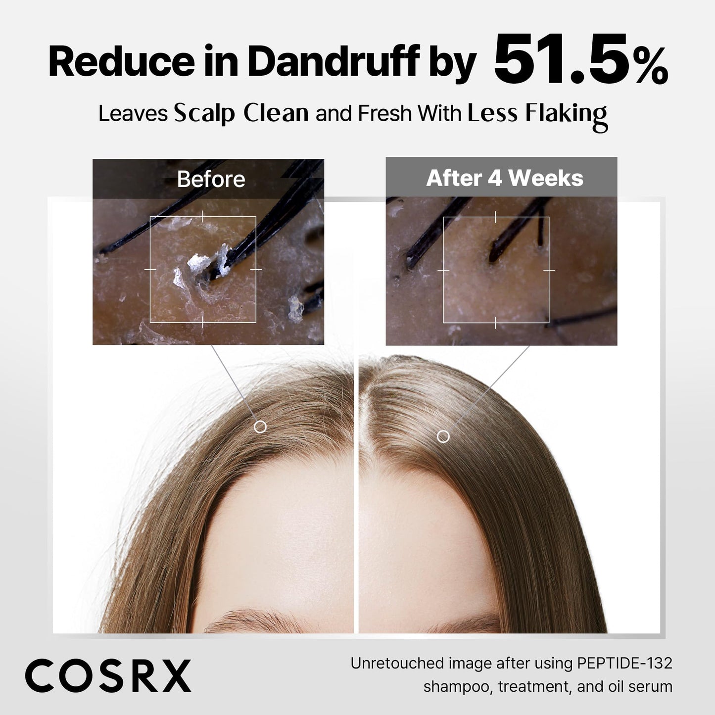 COSRX PEPTIDE 132 Hair Care Kit - Shampoo, Treatment & Oil Serum, Bond Repair Hair Gift Set for Damaged, Dry Hair, Scalp Treatment for Dandruff, Dry & Itchy Scalp, Travel Essential
