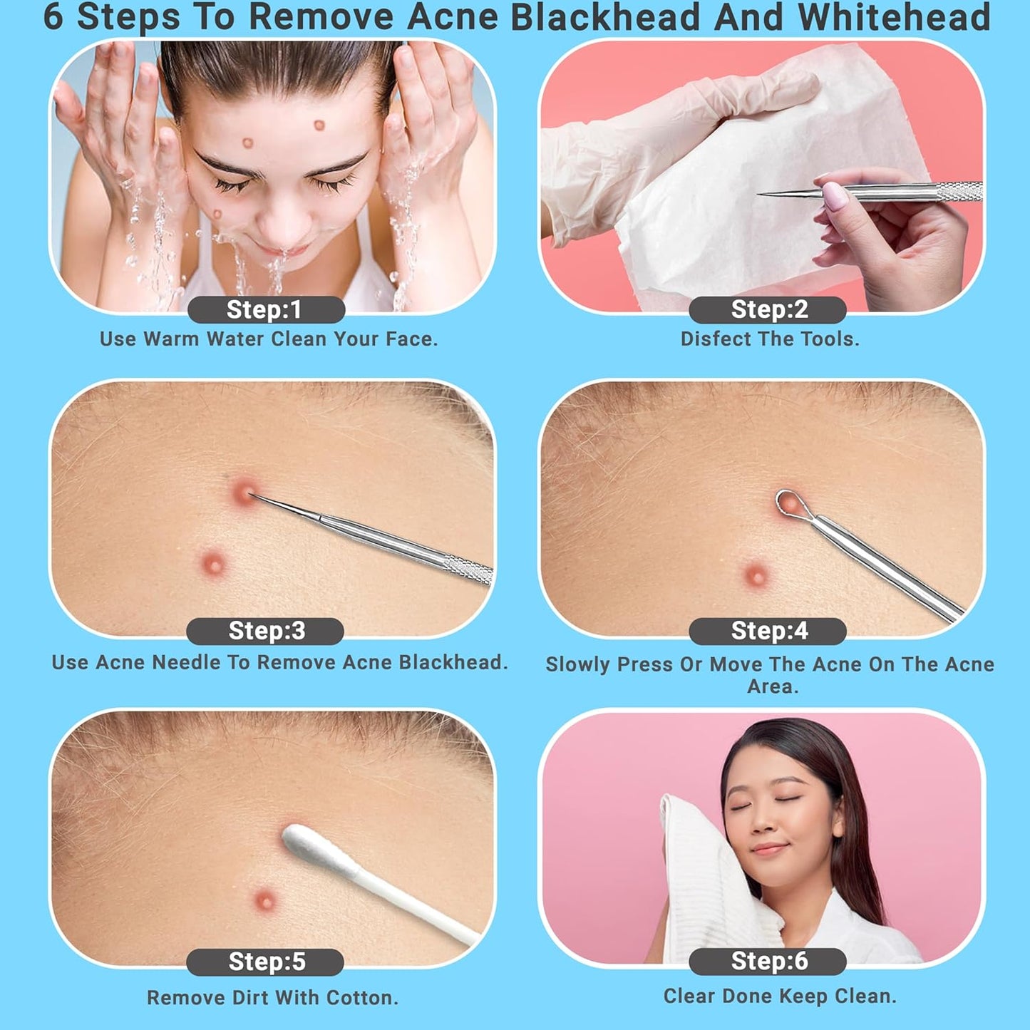 Stainless Steel Pimple Extractor Tool Set - Surgical Acne Treatment | Easy to Clean, 2 Pcs (Silver)