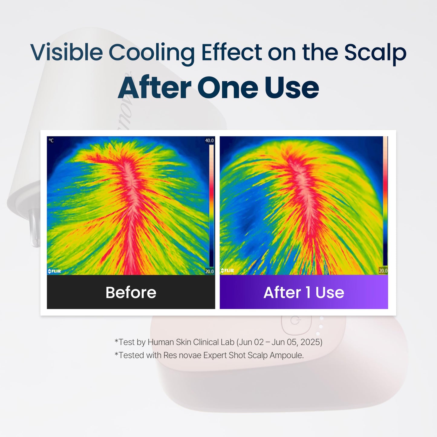 res novae Hyper Shot Scalp Care Device(Sunset Pink), Supports Ampoule Absorption, Scalp Vitality and Daily Scalp Massage at Home