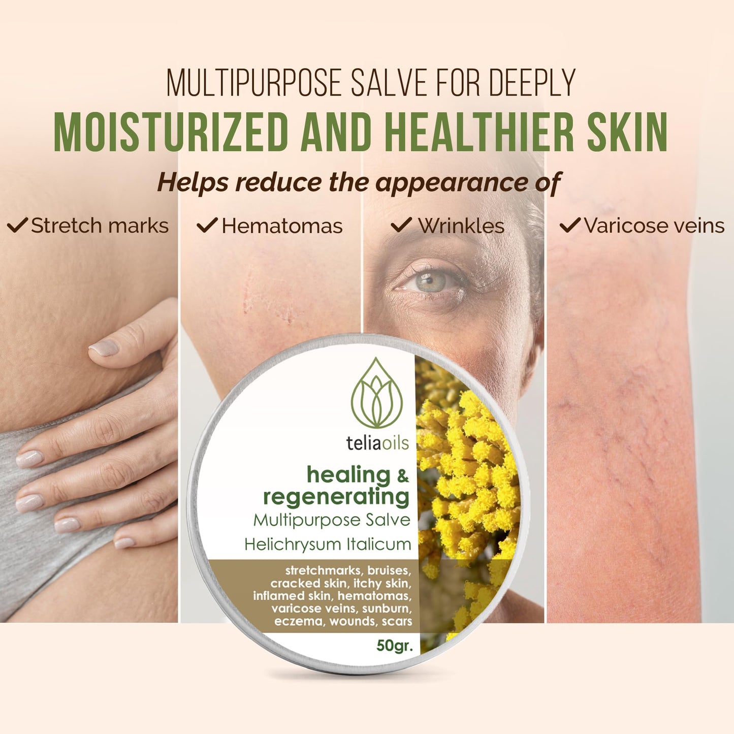 Teliaoils Helichrysum Italicum Multipurpose Salve | Helichrysum Oil | Soothing & Hydrating Relieving Balm | Irritated Skin, Stretch Marks, Varicose Veins & Wrinkles | Adults & Kids | 1.7oz/ 50gr |