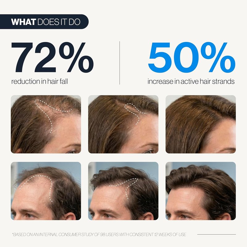 Hair Growth Serum Roll-On - 5% Saw Palmetto & 3% Rosemary Oil | Hair Regrowth for Men & Women - 25ml