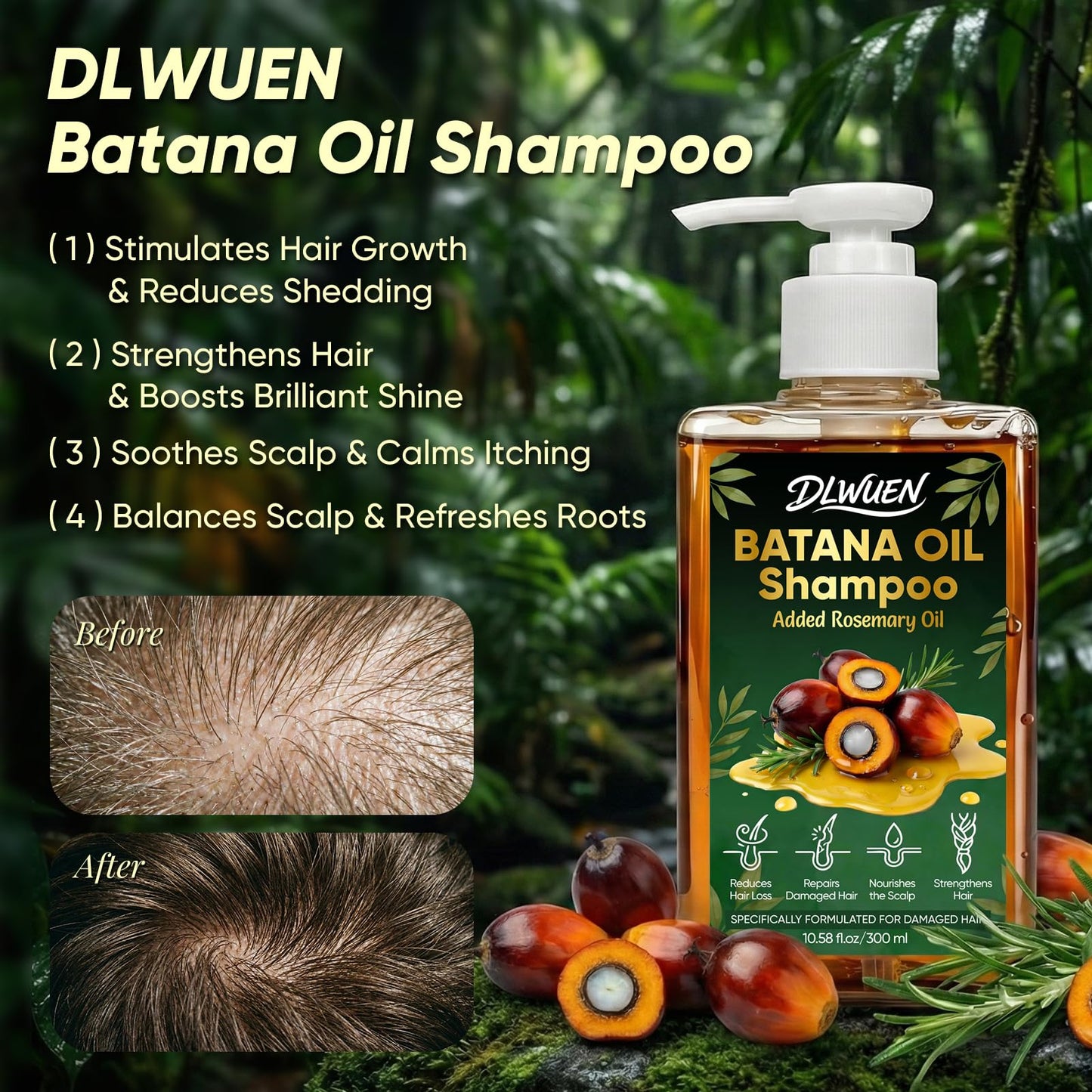 Batana Oil Shampoo for Hair Growth, Rosemary Shampoo Oil for Scalp Health, Reduces Hair Loss & Nourishes Scalp, Delivering Softness & Lasting Volume, Repairs Hair Damage for Men & Women 10.58 fl.oz