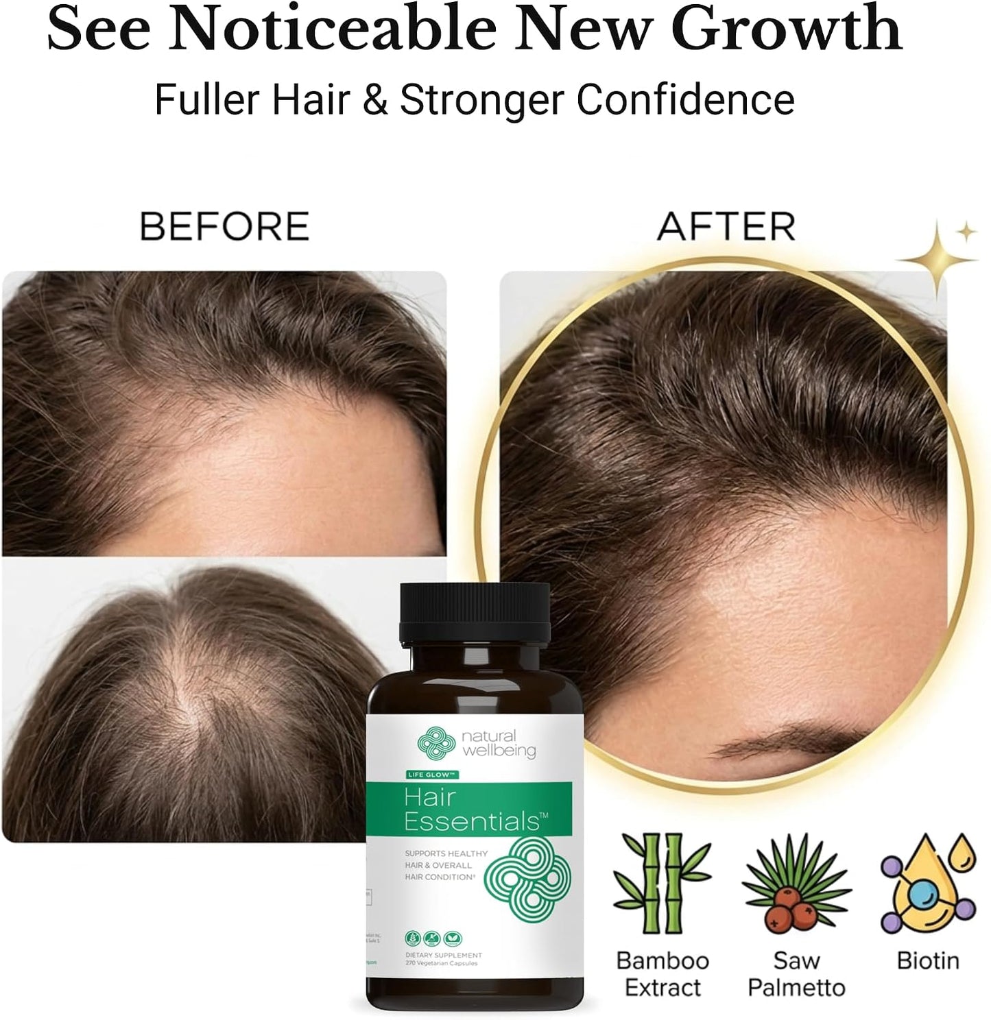 DHT Blocker Hair Growth Supplement - Natural Vegan Capsules for Men & Women | 270 Count, Stops Shedding & Thinning