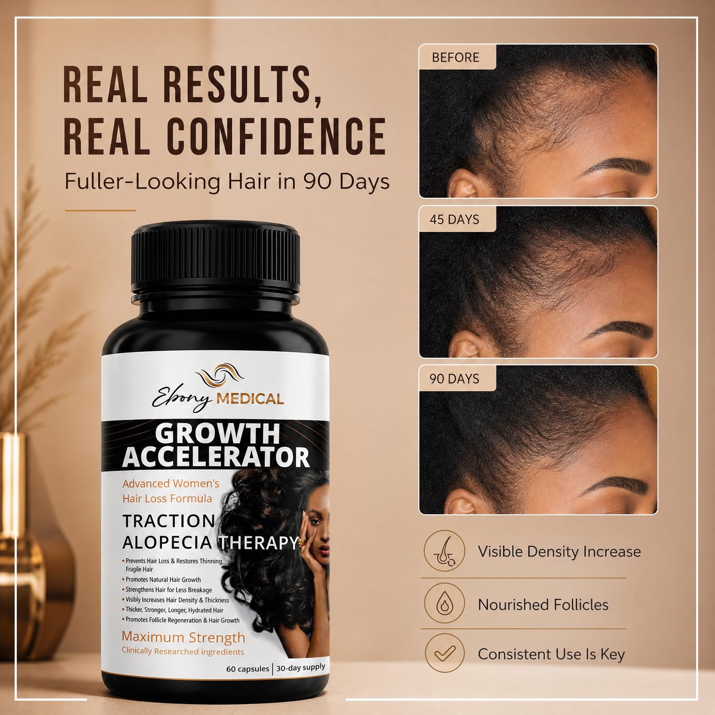 Ebony Medical Hair Support Supplement for Women of Color – Thinning Hair & Traction Alopecia Support – Keratin Boost, Follicle Nourishment, and Hair Strength Vitamins – 30-Day Supply