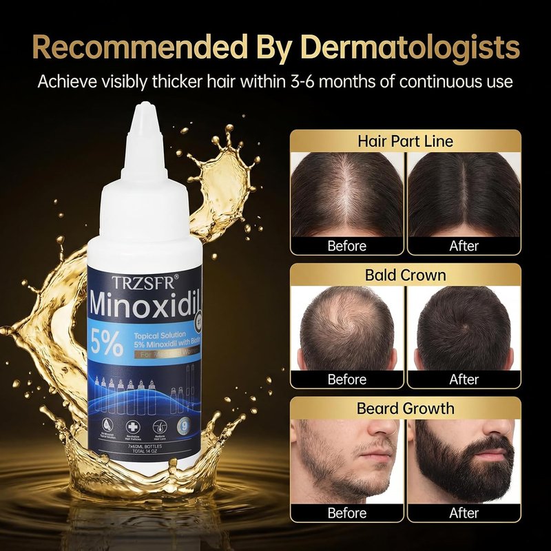 Minoxidil 5% Hair Growth Solution - Extra Strength for Men & Women | 7 Bottles, Roller & Precision Applicators