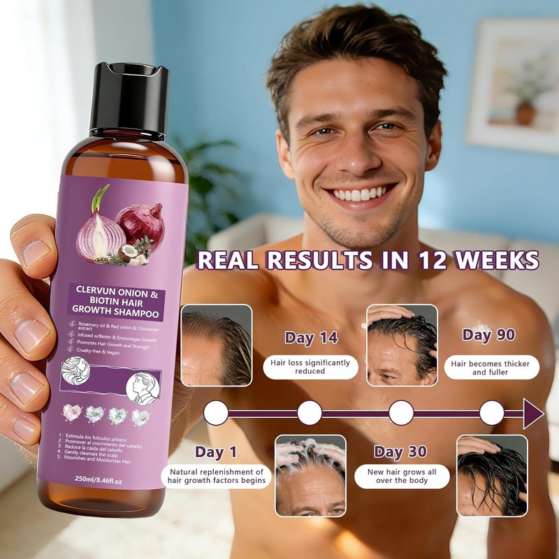 Onion Shampoo for Hair Growth - Biotin & Rosemary Oil for Thicker, Stronger Hair | Anti-Hair Loss Formula