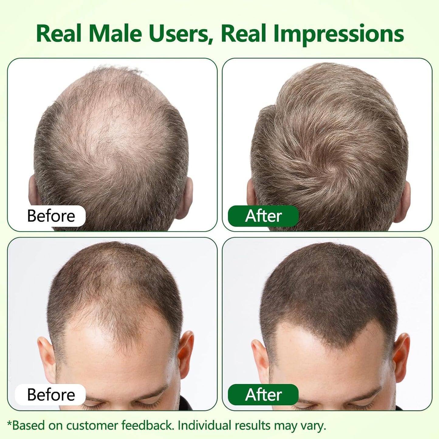 Hair Growth Serum Roll-On - Strengthens Roots & Reduces Shedding | 3% Rosemary, 2% Ginger, 0.85 Fl Oz (Pack of 2)