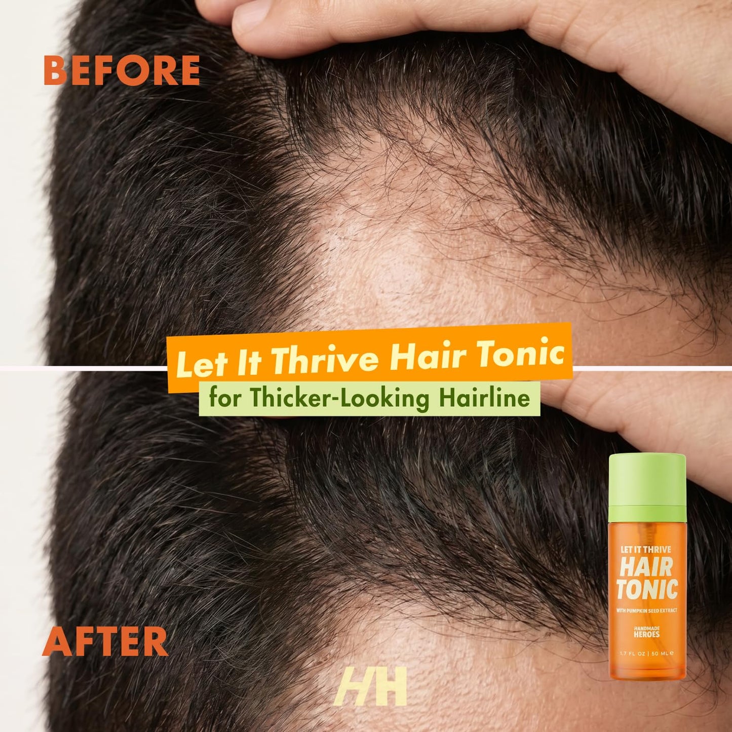 Handmade Heroes 100% Natural Rosemary Hair Tonic with Pumpkin Seed Extract for Hair Thinning - Hair Tonic for Men and Women - Thickening and Lusher Looking Hair
