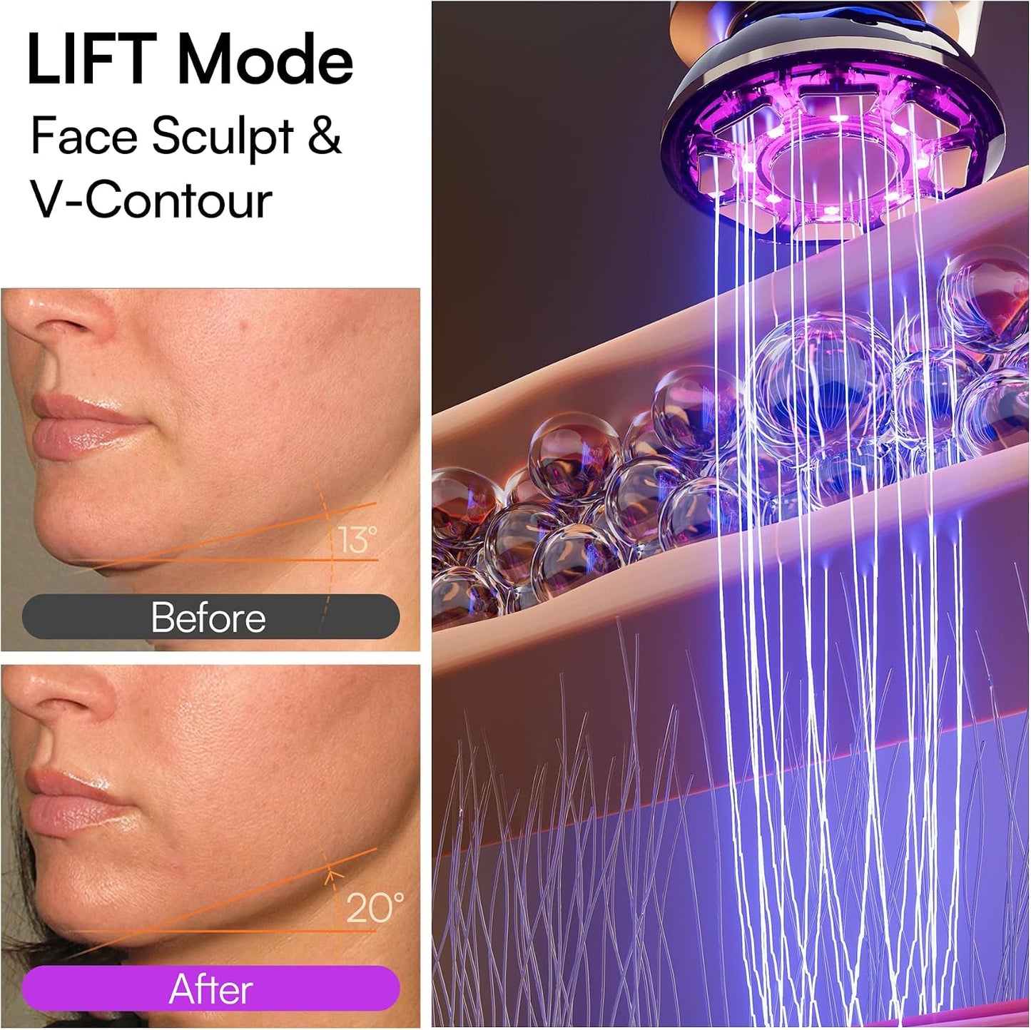 INIA Microcurrent Facial Device - 3-in-1 Red Light Therapy Massager for Puffiness, Firming & Smoothing | Heat & Vibration