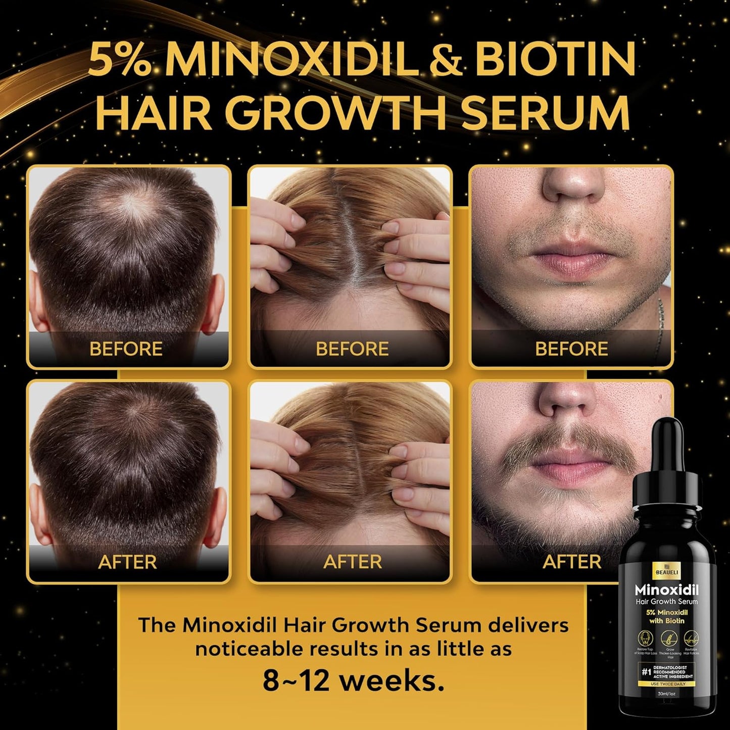 Minoxidil 5% Hair Growth Treatment for Men & Women | Unisex Beard Growth, 1oz