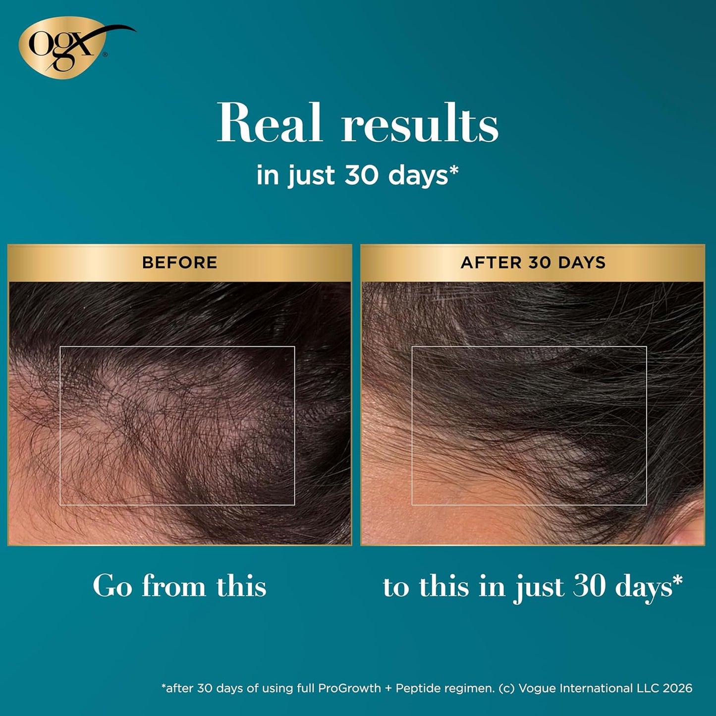 OGX ProGrowth + Peptide Scalp Serum - Nourishing Hair Growth Formula | 0.33 Fl Oz