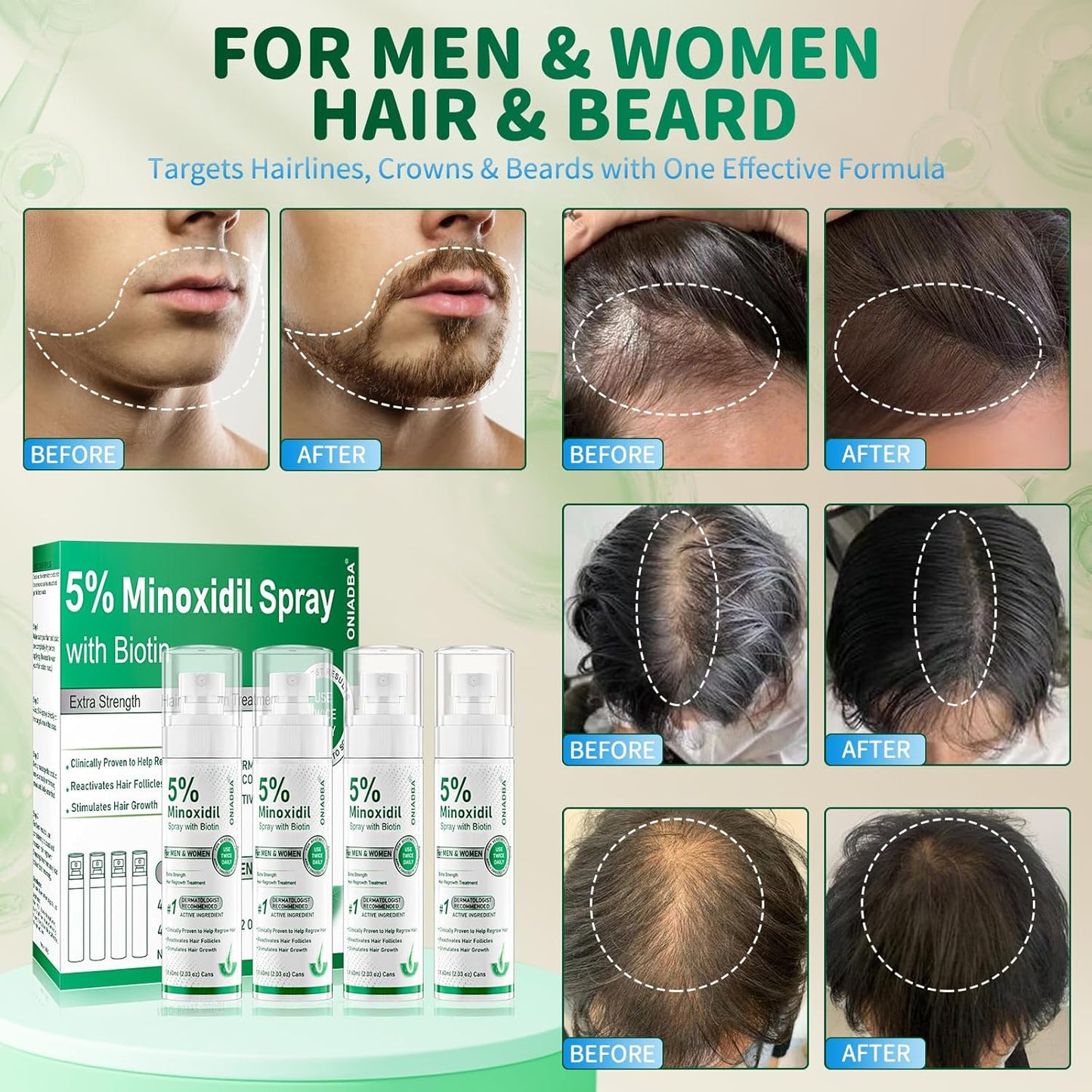 5% Minoxidil Hair Growth Spray - Extra Strength Regrowth Treatment with Biotin & Castor Oil | 4-Pack (8.12oz) for Men & Women