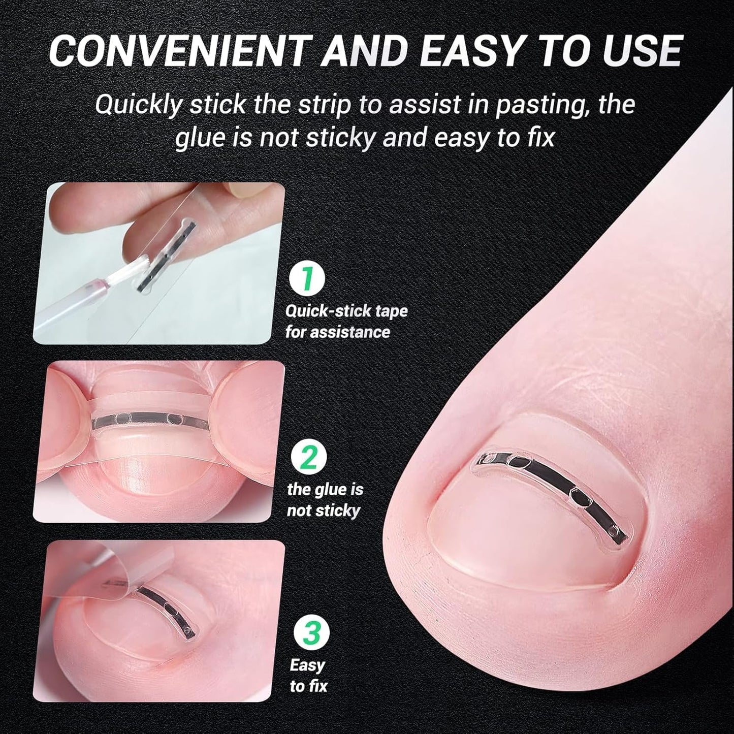 Ingrown Toenail Treatment Kit - Titanium Alloy Nail Tools for Curved Nail Repair | 0.59/0.67in