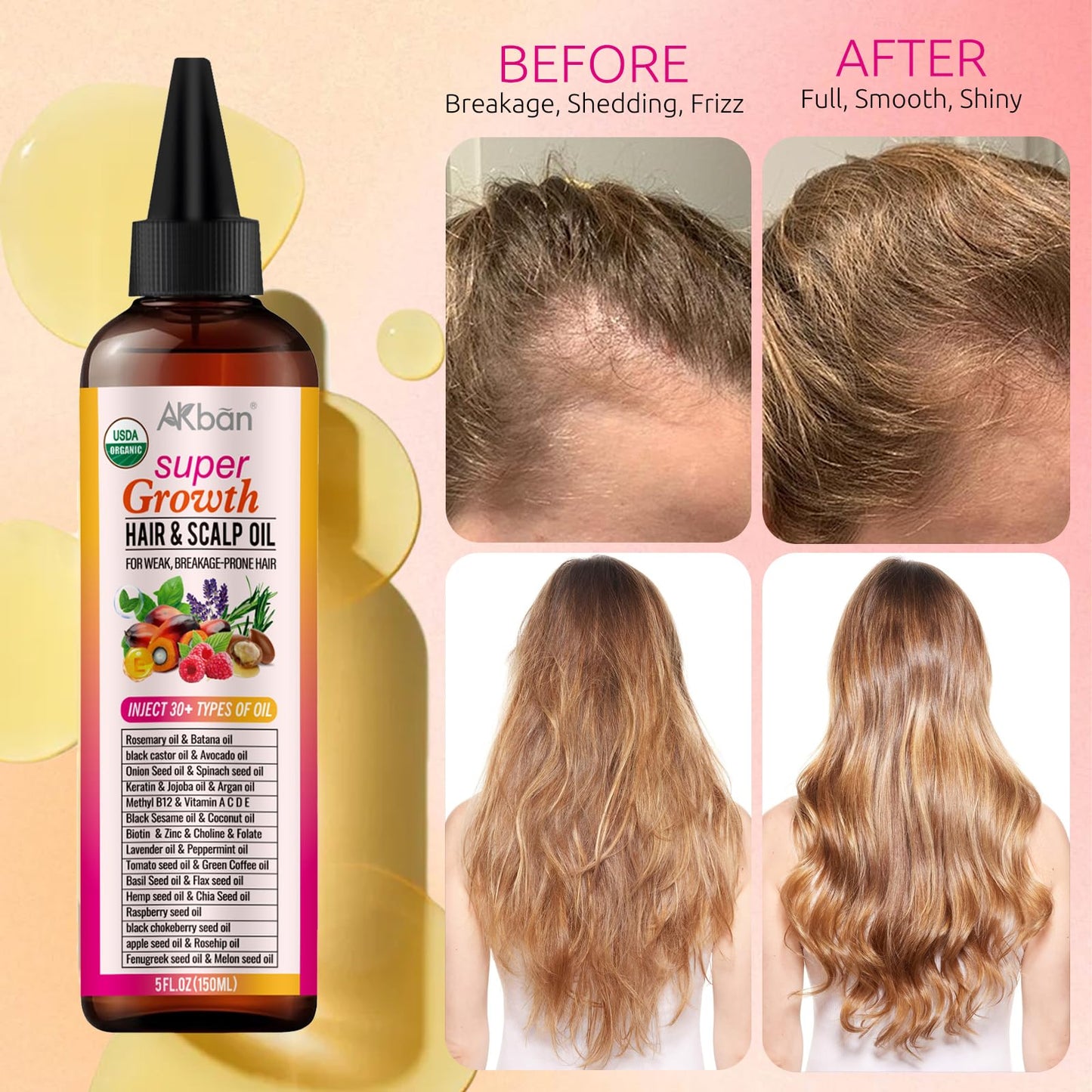 Super Blend of Pure Rosemary Oil for Hair Growth with Black Castor, Batana, Argan, Jojoba, Infused with Keratin & Biotin, Blend Scalp and Hair Oil for Hair Strengthening, Moisture, Shine, Protection