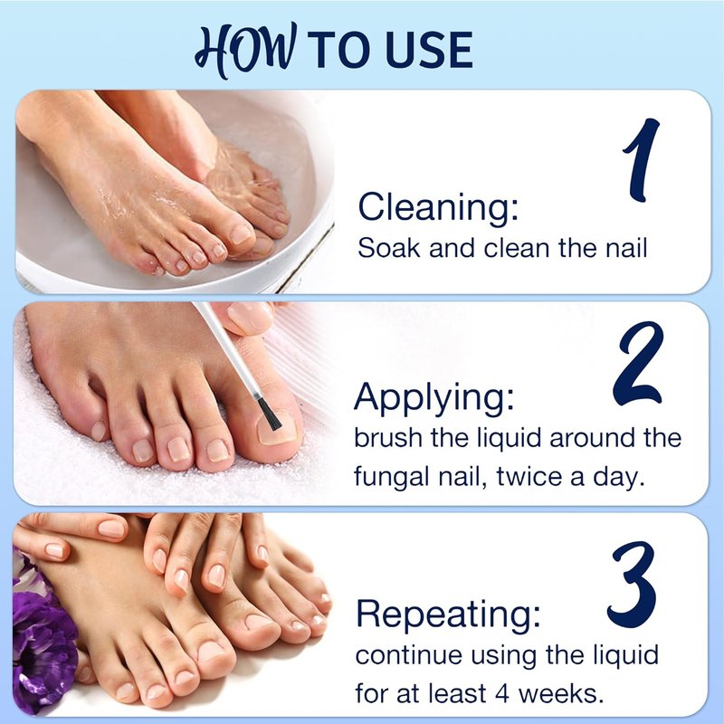 Toenail Fungus Treatment - 30% Undecylenic Acid with Natural Oils | Includes Nail Bandage, File & Brush for Ingrown Nails