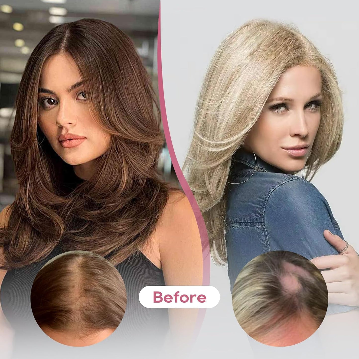 REECHO Human Hair Toppers - Real Thick Hair Topper for Women | Invisible Wiglet for Daily Volume, Medium Brown with Highlights