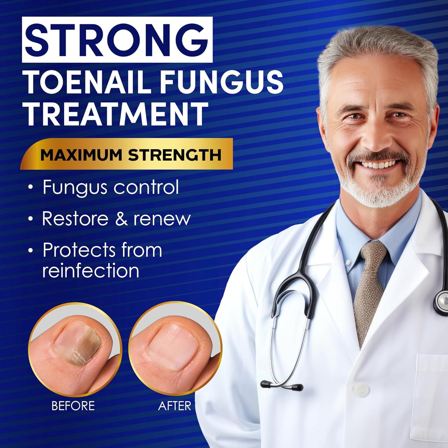 Toenail Fungus Treatment - Extra Strength Solution with Undecylenic Acid & Tea Tree Oil | 15ml, 2 Bottles