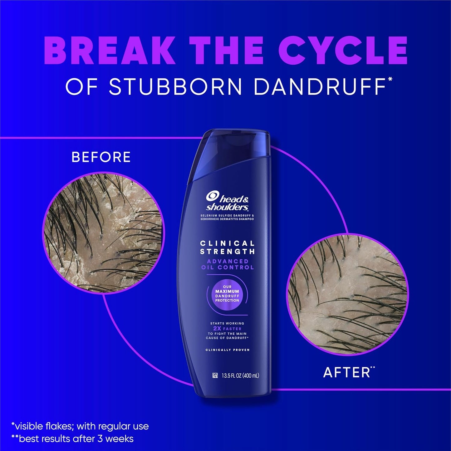 Head & Shoulders Anti-Dandruff Shampoo - Clinical Strength 1% Selenium Sulfide for Oily Scalp | 13.5 fl oz Each