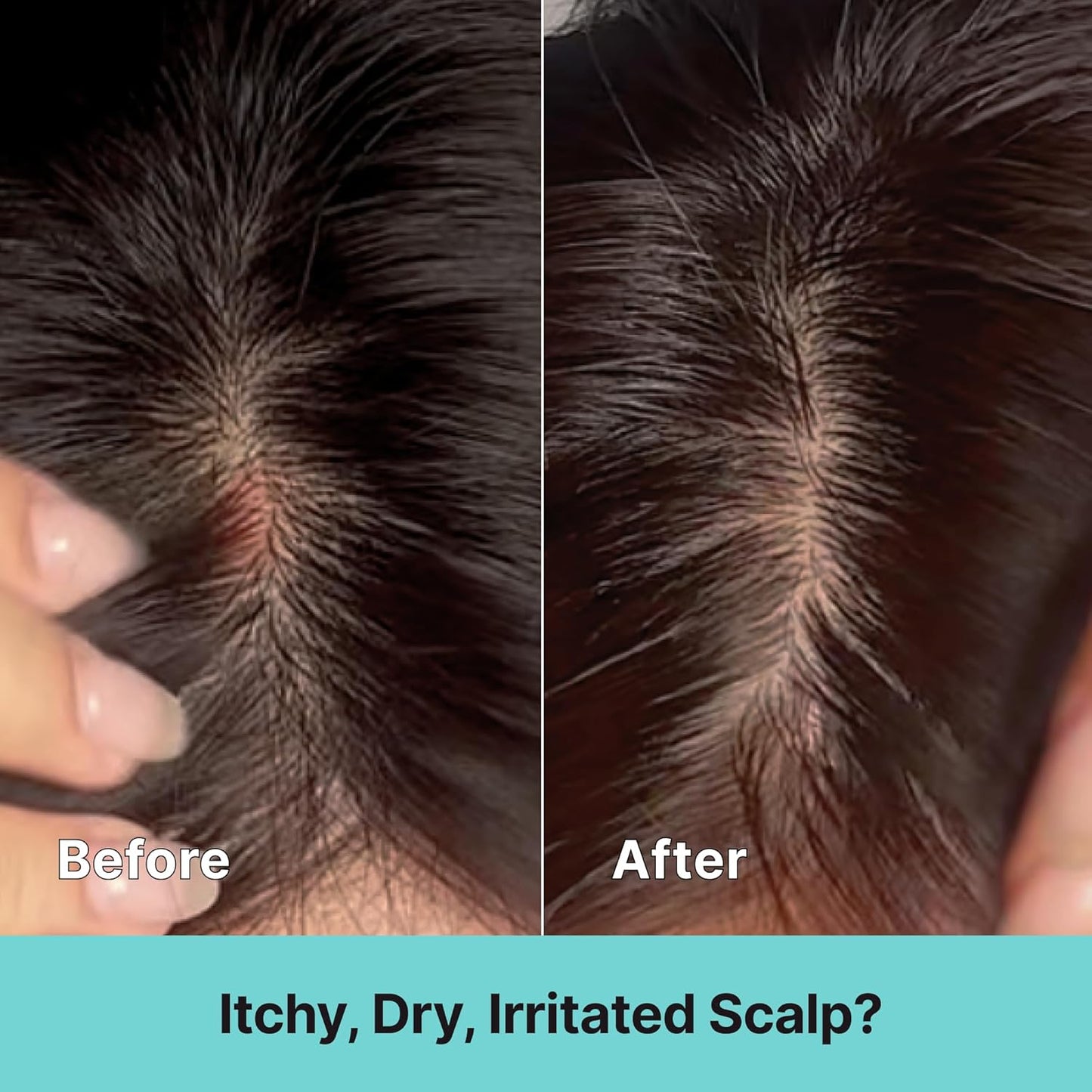Kelp Scalp Treatment Spray - Soothing Relief for Itchy & Sensitive Scalp | Lightweight Korean Leave-In, 80ml