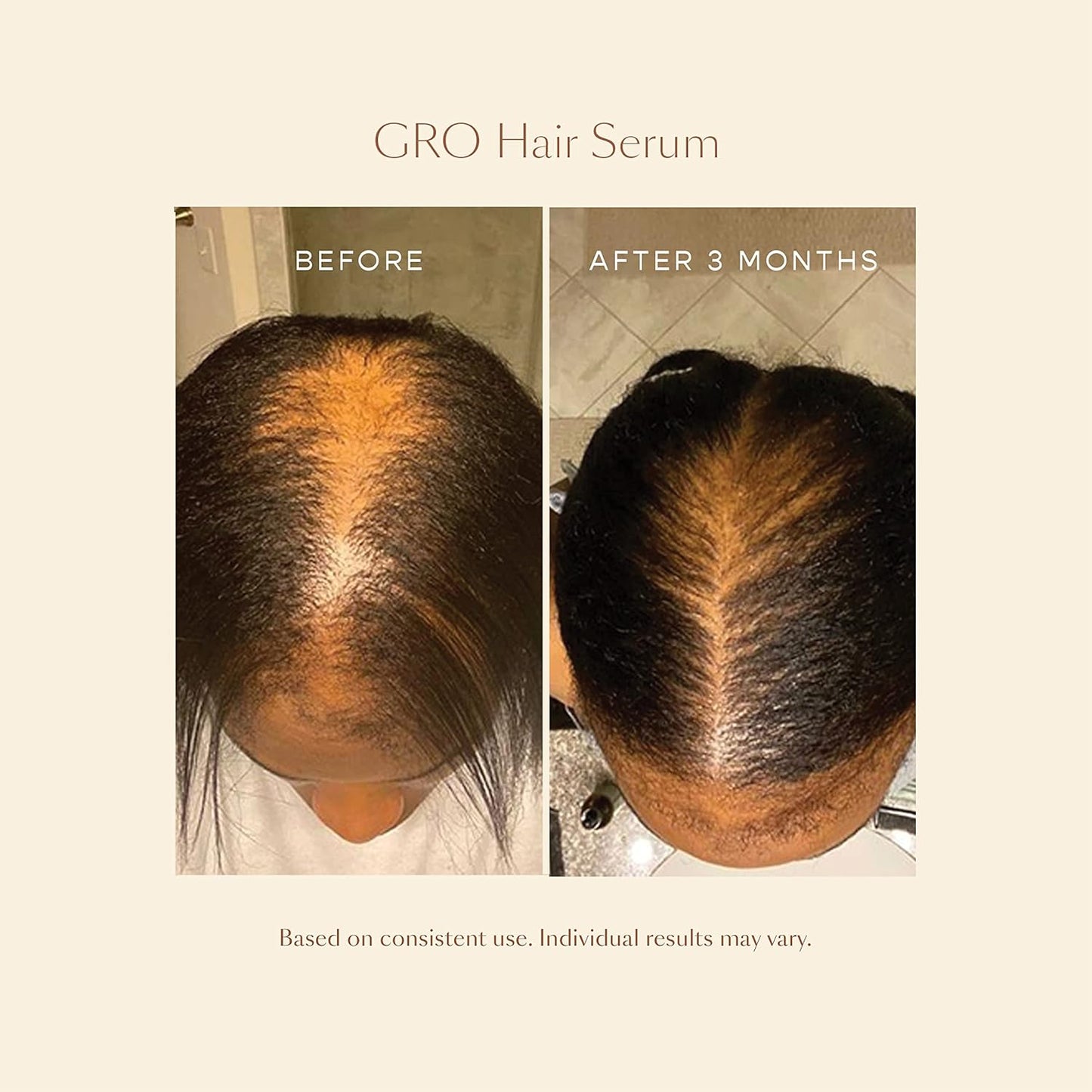 GRO More Kit - Hair Growth Serum & Gummies for Volumized Hair | Nourishing Formula