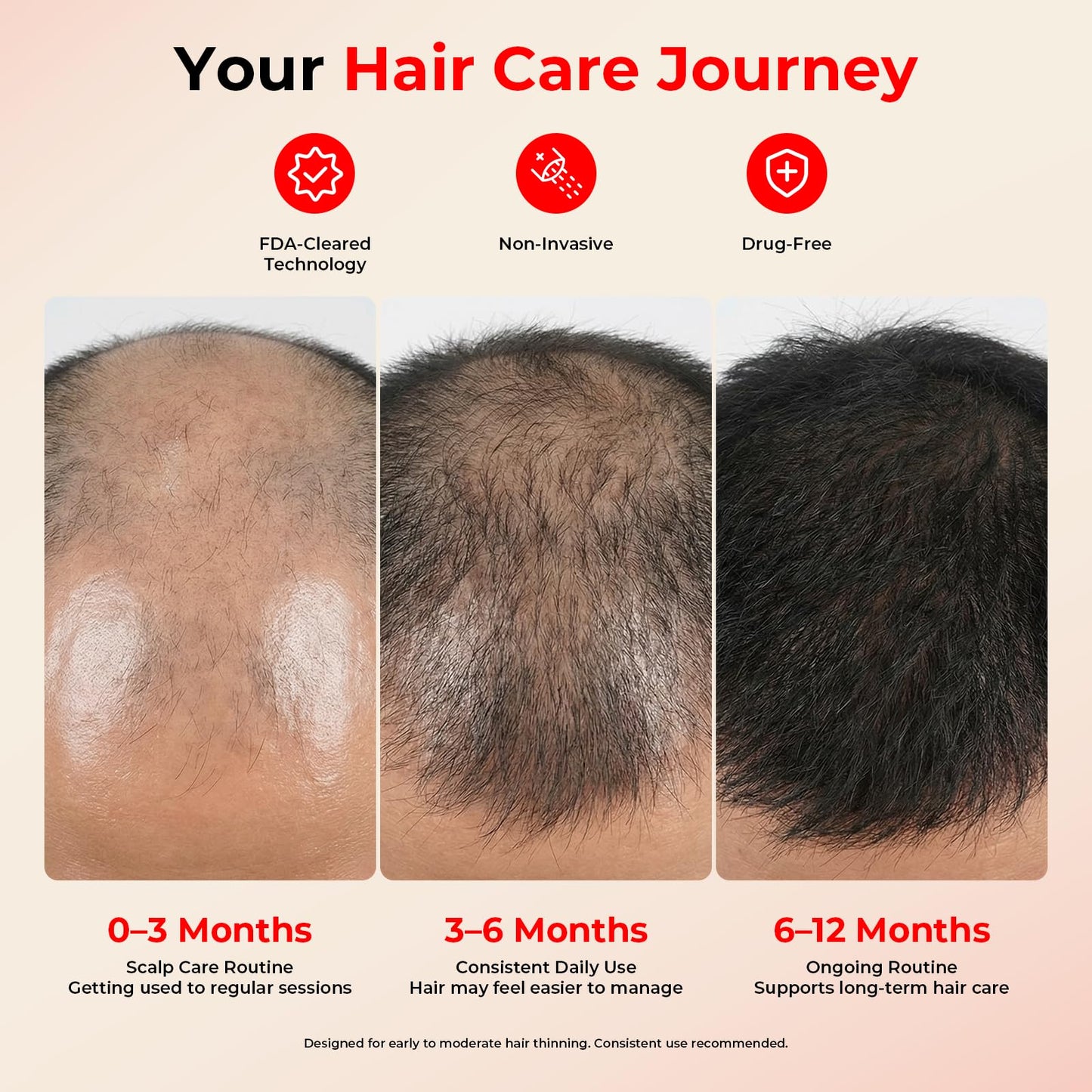 CAYAMA Red Light Hair Growth Cap, 528 Light Emitters, Full Scalp Coverage, Stable Corded Power, Consistent At-Home Sessions for Men & Women