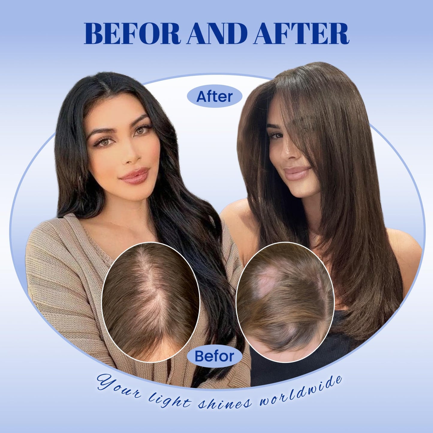 WORLDSTAR Toppers for Women Real Human Hair, Hair Topper with No Bangs, 360° 3D Cover,14Inch,6 * 7 Inch Base,65g,#2/6/18 Dark Brown to Chestnut Brown and Dirty Blonde, Clip in Topper (tp#2/6/18-14)