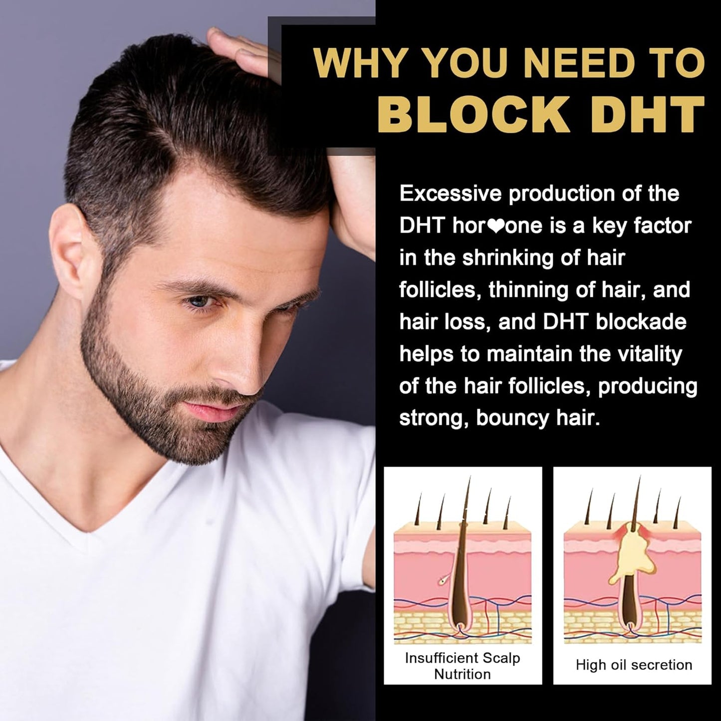 DHT Blocker Gummies - Hair Growth Supplement with Saw Palmetto & Biotin 10000 mcg | Prevent Hair Loss & Balance DHT