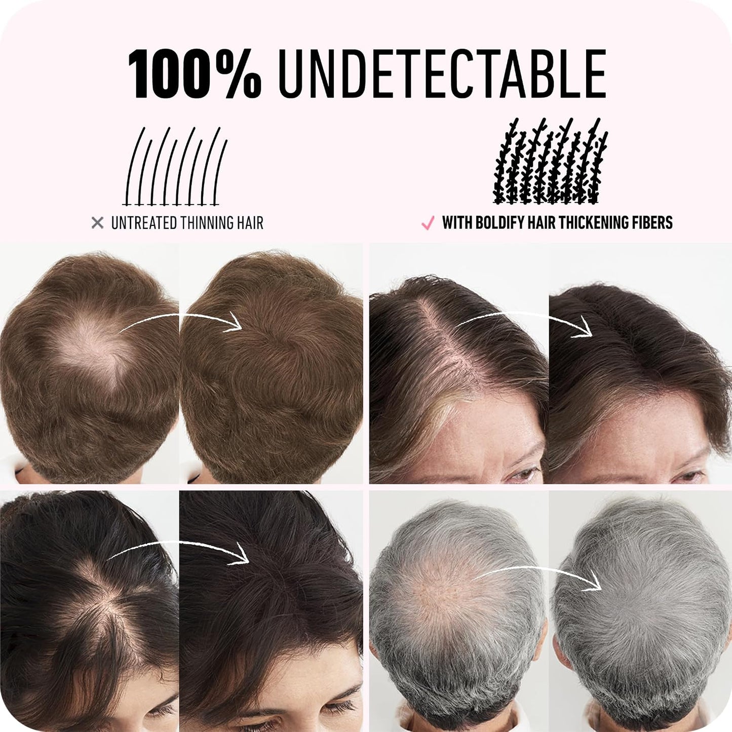 BOLDIFY Hair Fibers - Thinning Hair Solution for Fuller, Thicker Look | 28g Dark Gray - 14 Shades Available
