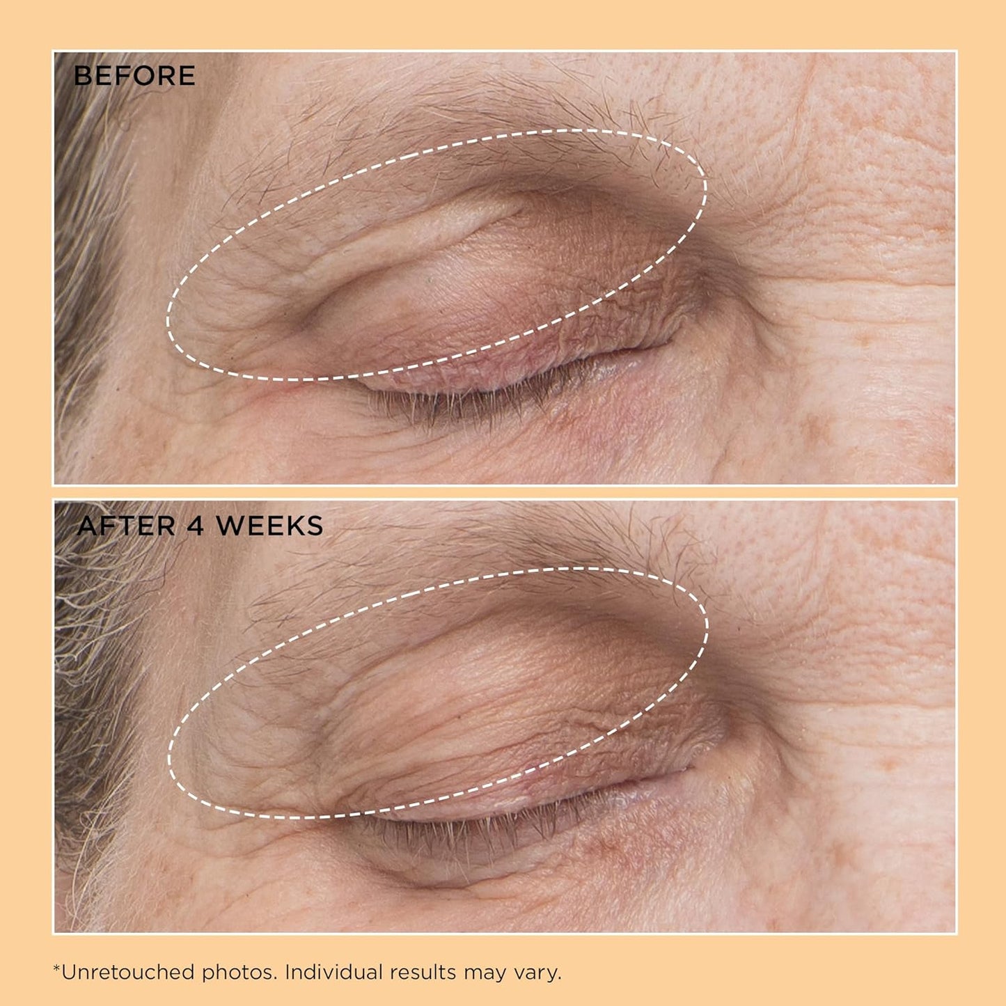 Perricone MD Neuropeptide Eyelid Lift Serum - Anti-Aging Formula, 0.5 fl oz